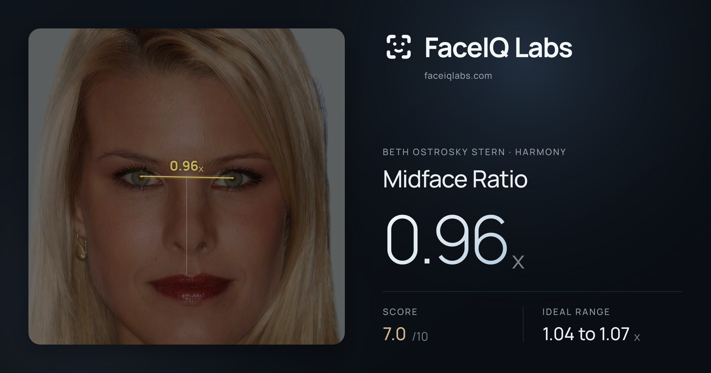 Beth Ostrosky Stern Midface Ratio: 0.96x, drawn on the photo