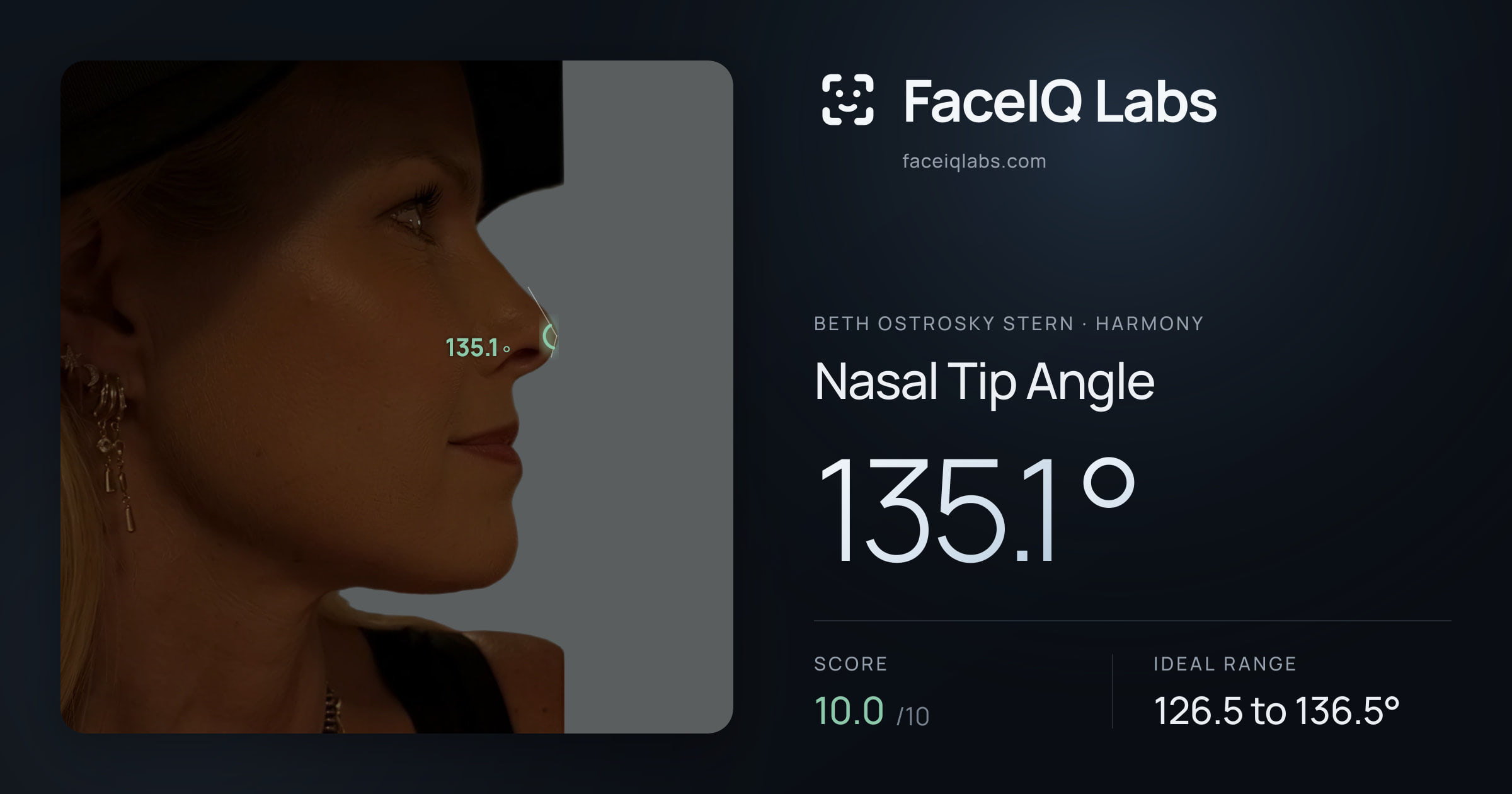 Beth Ostrosky Stern Nasal Tip Angle: 135.1°, drawn on the photo