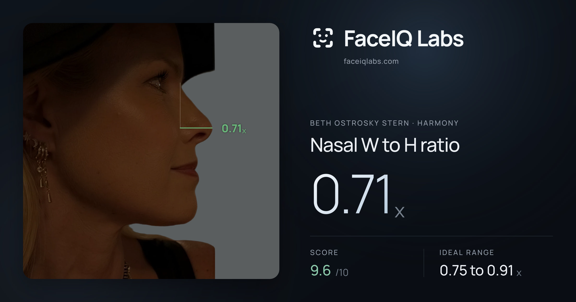 Beth Ostrosky Stern Nasal W to H ratio: 0.71x, drawn on the photo