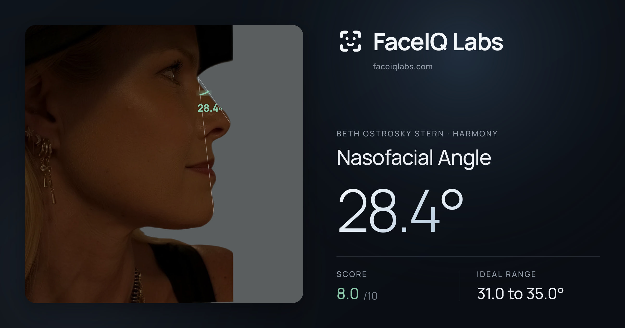 Beth Ostrosky Stern Nasofacial Angle: 28.4°, drawn on the photo