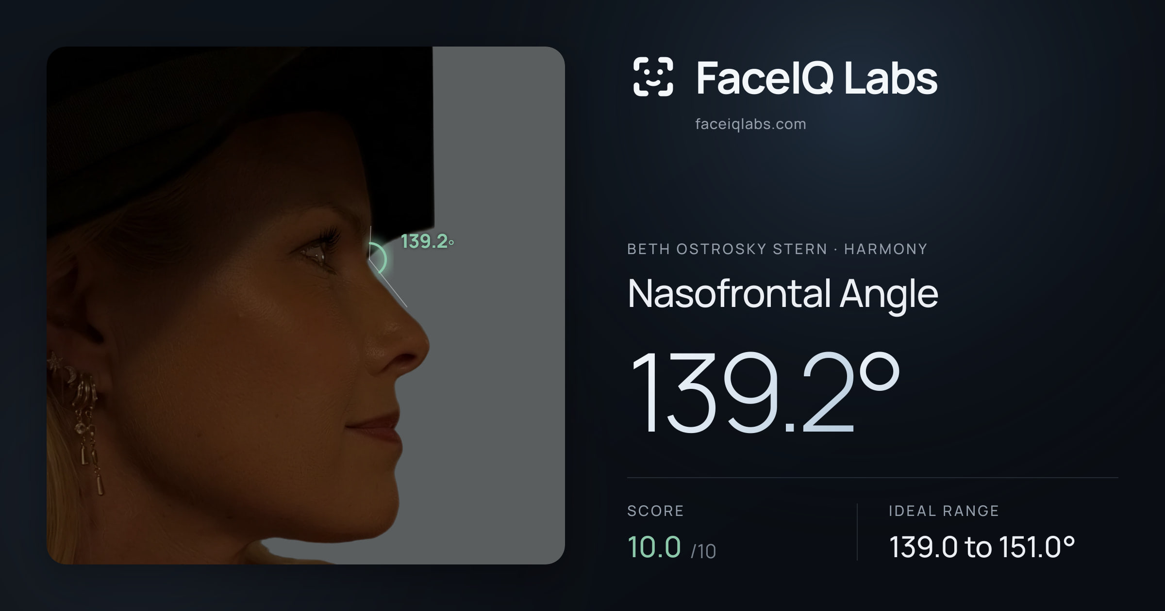 Beth Ostrosky Stern Nasofrontal Angle: 139.2°, drawn on the photo