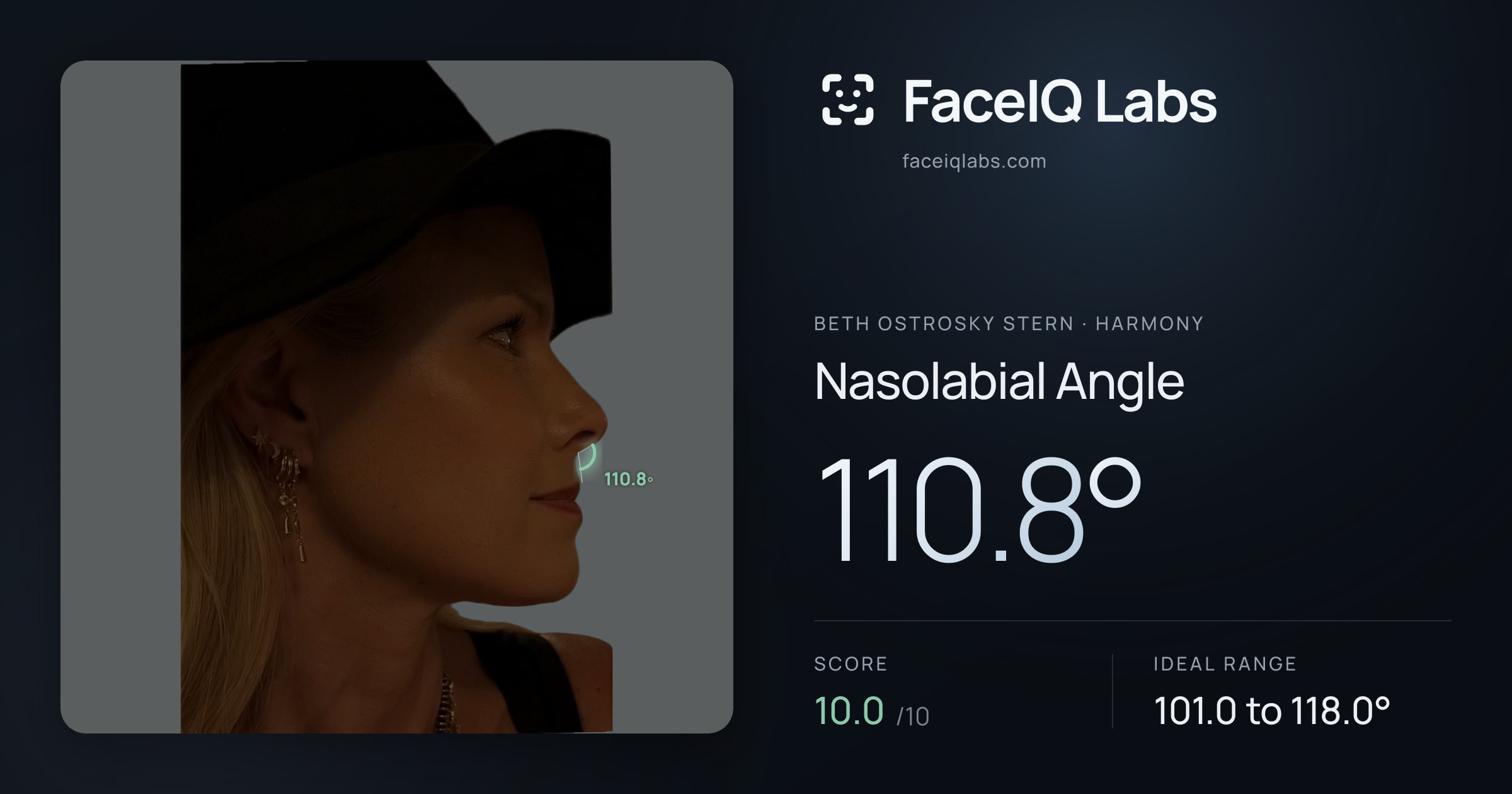 Beth Ostrosky Stern Nasolabial Angle: 110.8°, drawn on the photo