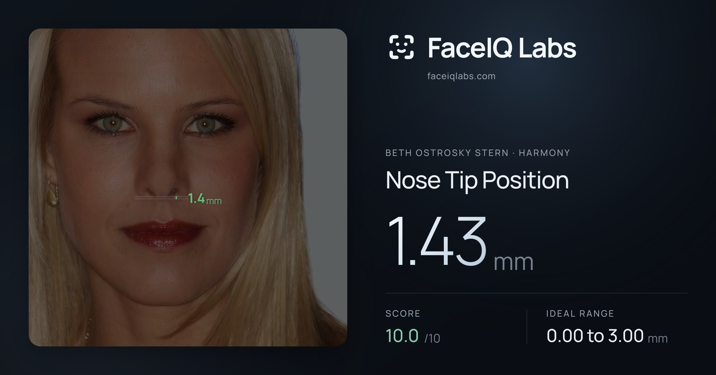 Beth Ostrosky Stern Nose Tip Position: 1.43mm, drawn on the photo