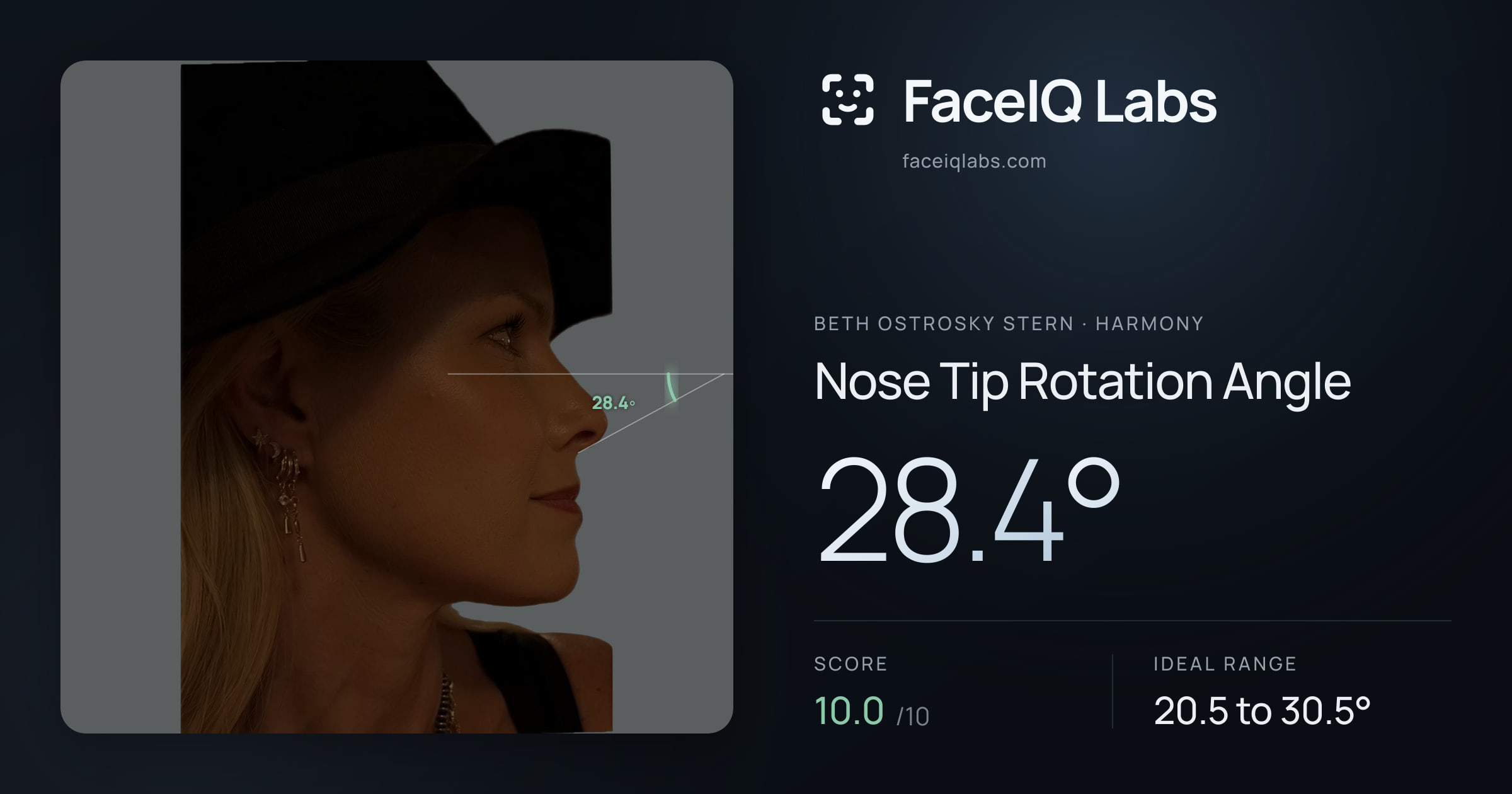 Beth Ostrosky Stern Nose Tip Rotation Angle: 28.4°, drawn on the photo