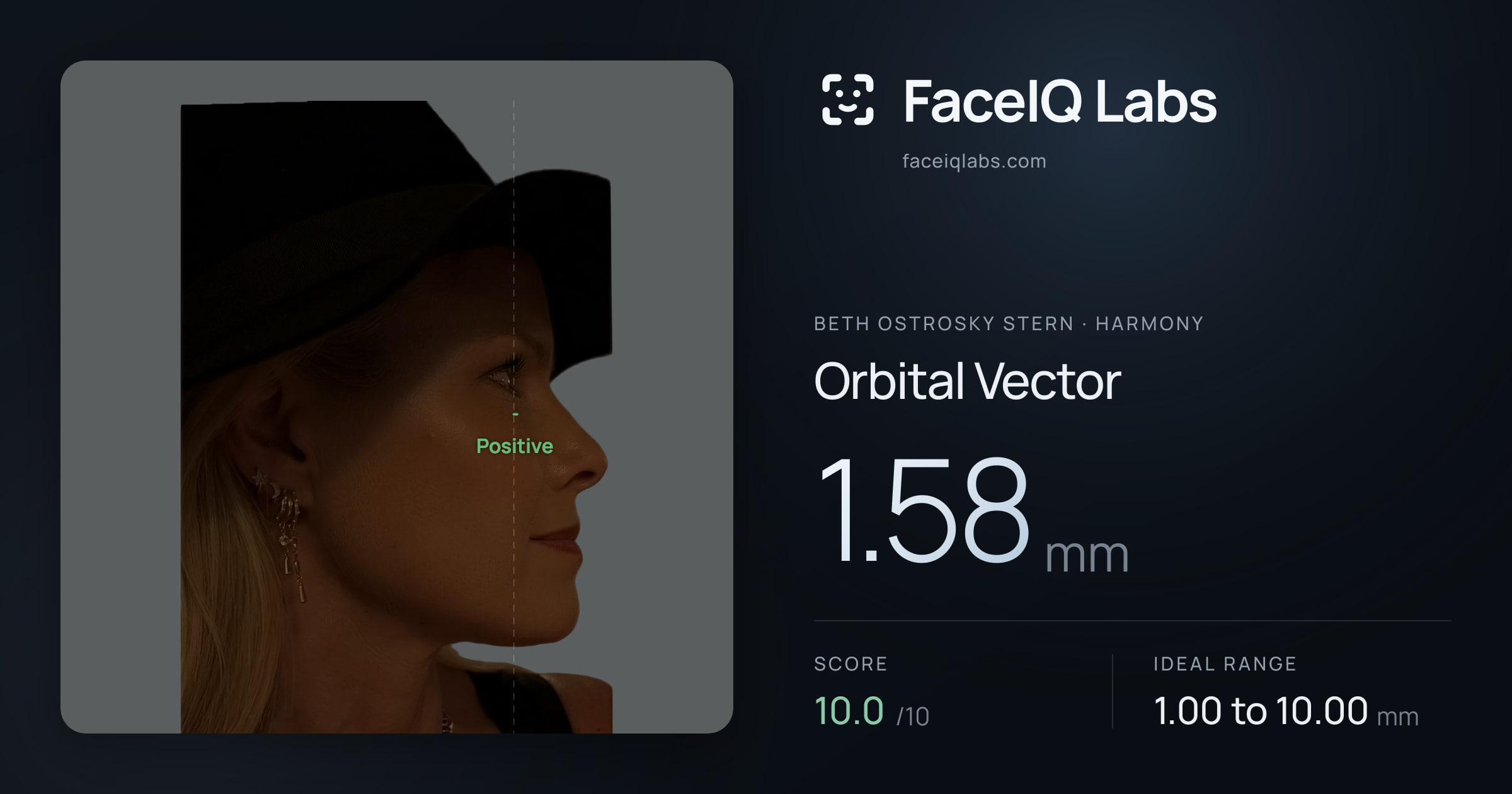 Beth Ostrosky Stern Orbital Vector: 1.58mm, drawn on the photo