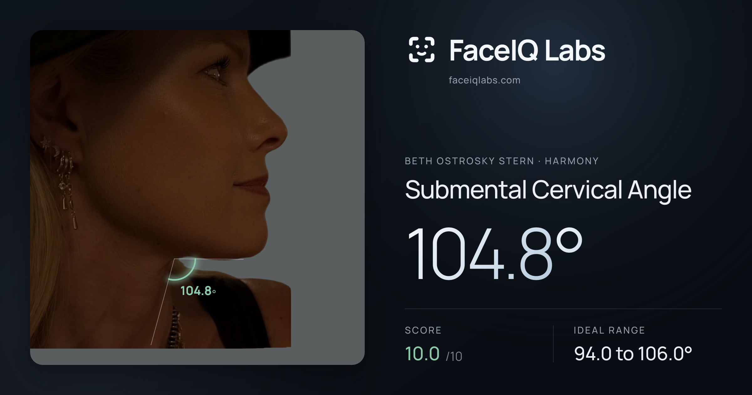 Beth Ostrosky Stern Submental Cervical Angle: 104.8°, drawn on the photo