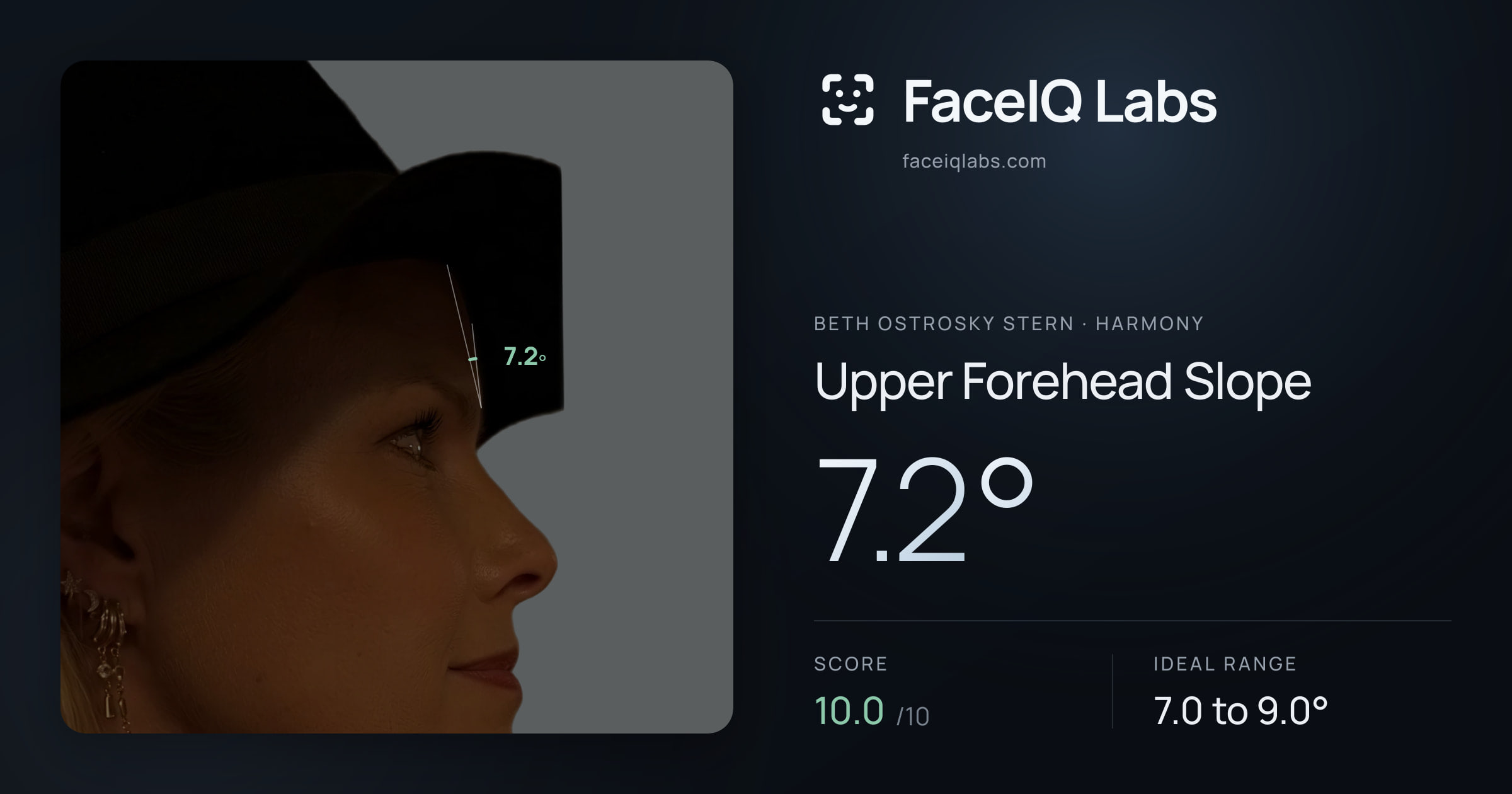 Beth Ostrosky Stern Upper Forehead Slope: 7.2°, drawn on the photo