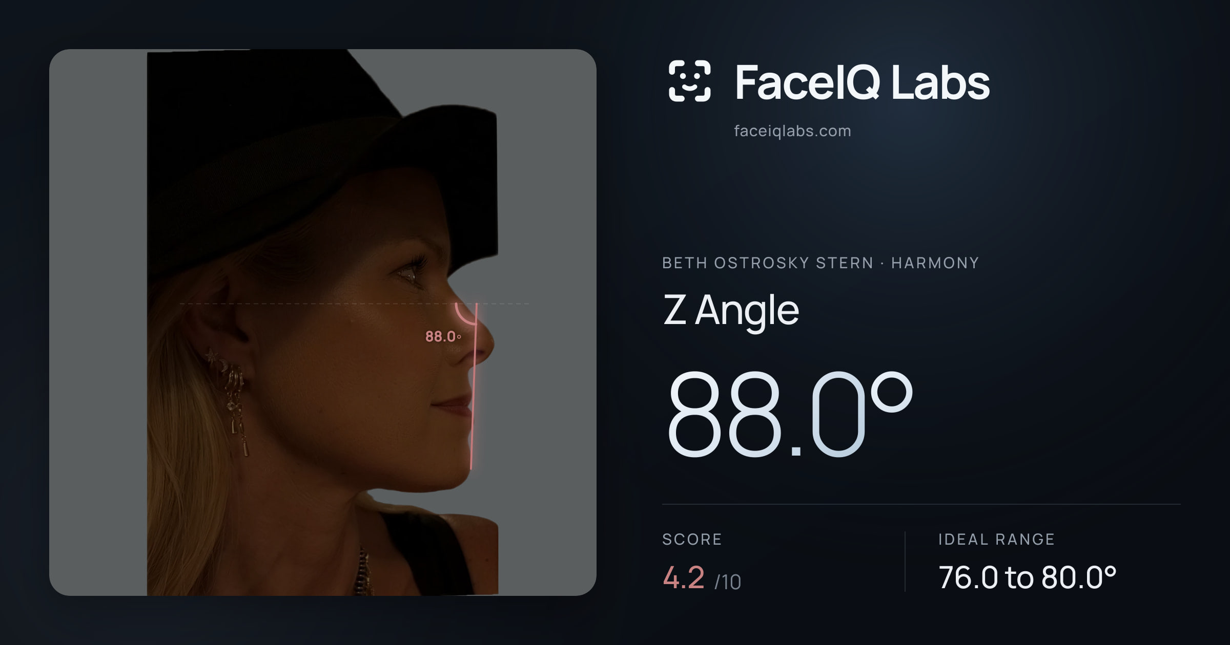 Beth Ostrosky Stern Z Angle: 88.0°, drawn on the photo