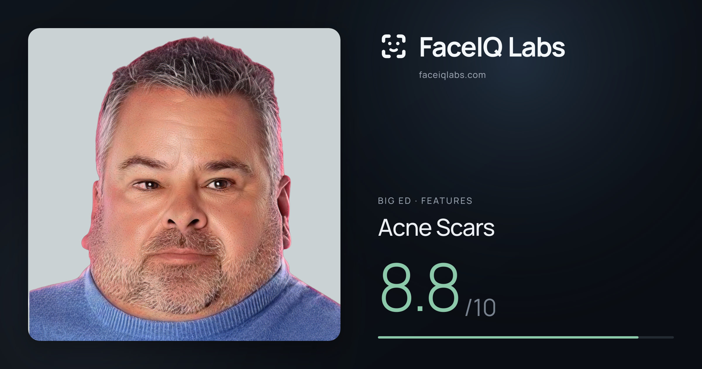 Big Ed Acne Scars: 8.8/10, drawn on the photo