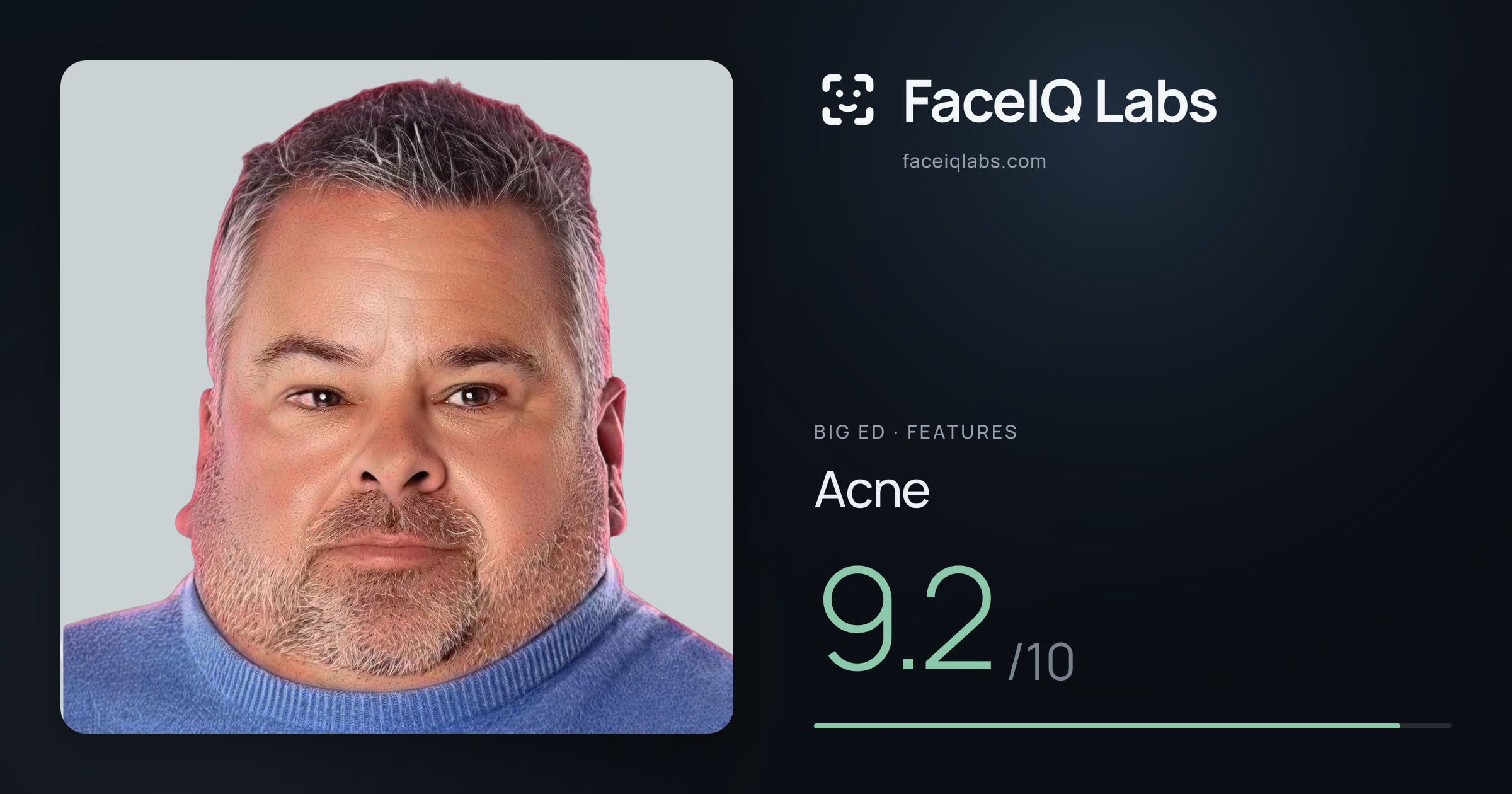 Big Ed Acne: 9.2/10, drawn on the photo