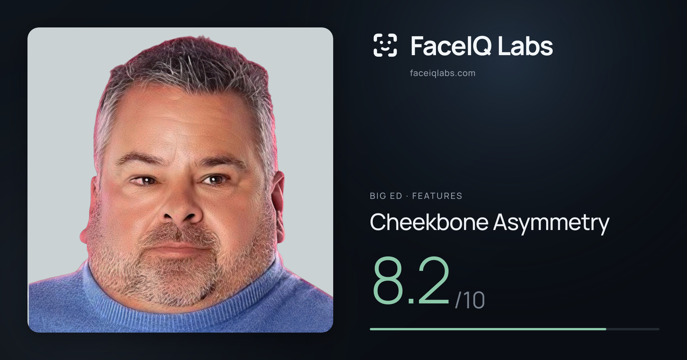 Big Ed Cheekbone Asymmetry: 8.2/10, drawn on the photo