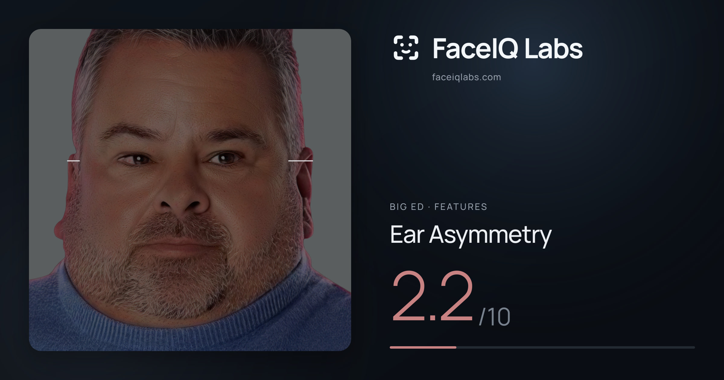 Big Ed Ear Asymmetry: 2.2/10, drawn on the photo
