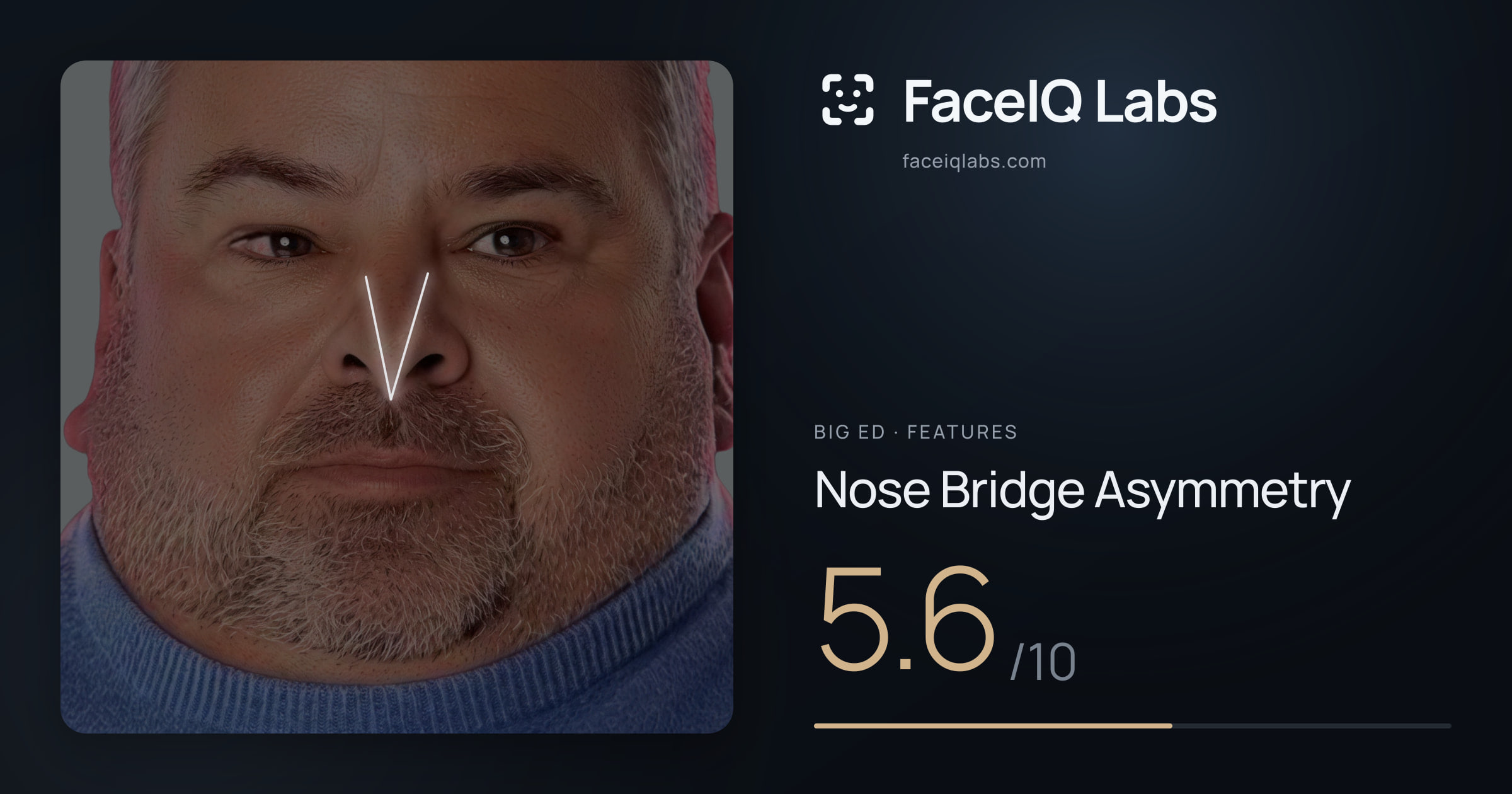 Big Ed Nose Bridge Asymmetry: 5.6/10, drawn on the photo