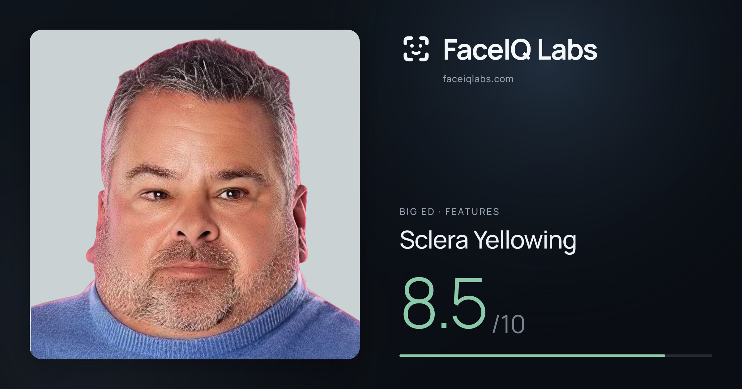Big Ed Sclera Yellowing: 8.5/10, drawn on the photo