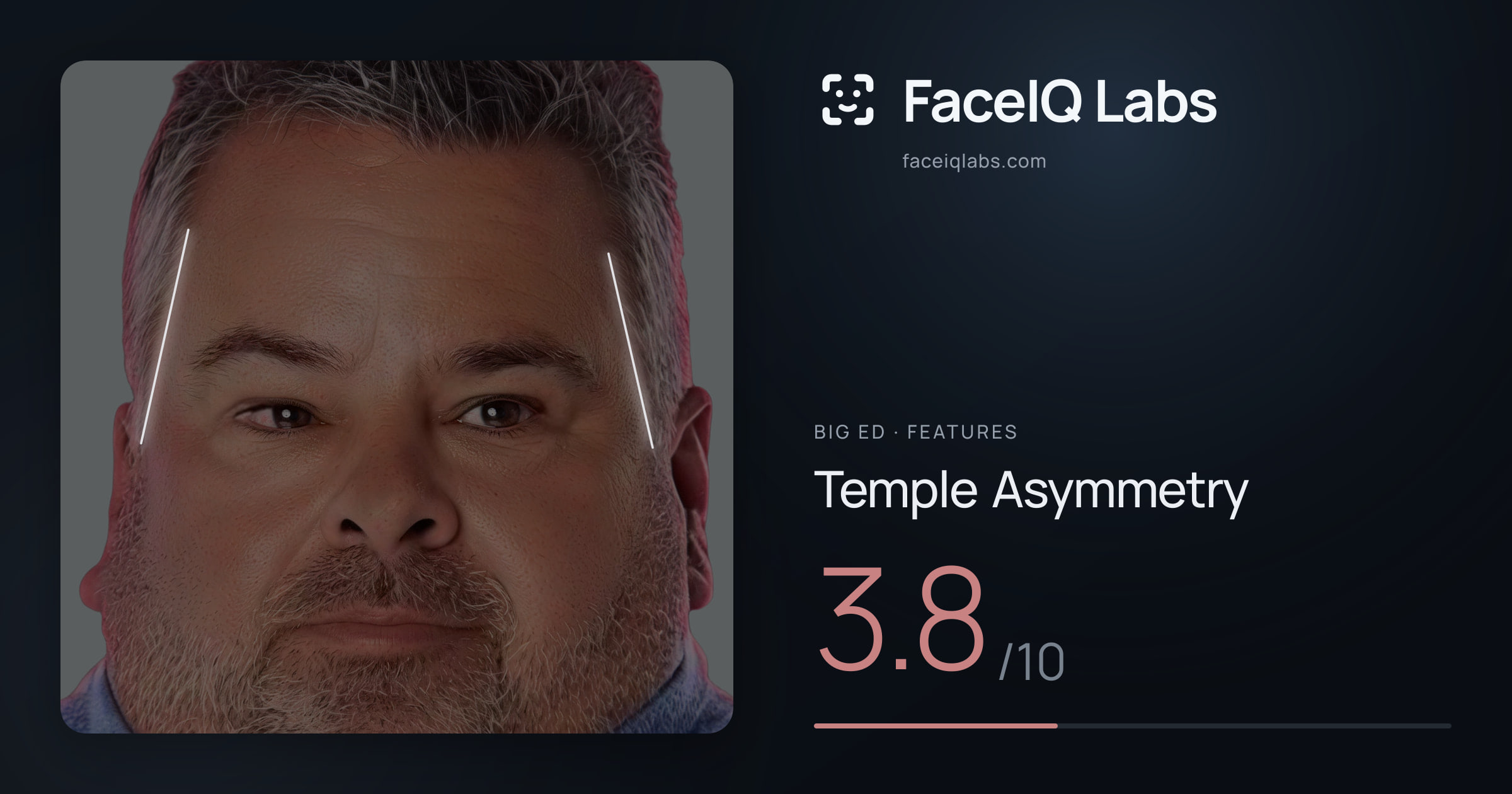 Big Ed Temple Asymmetry: 3.8/10, drawn on the photo