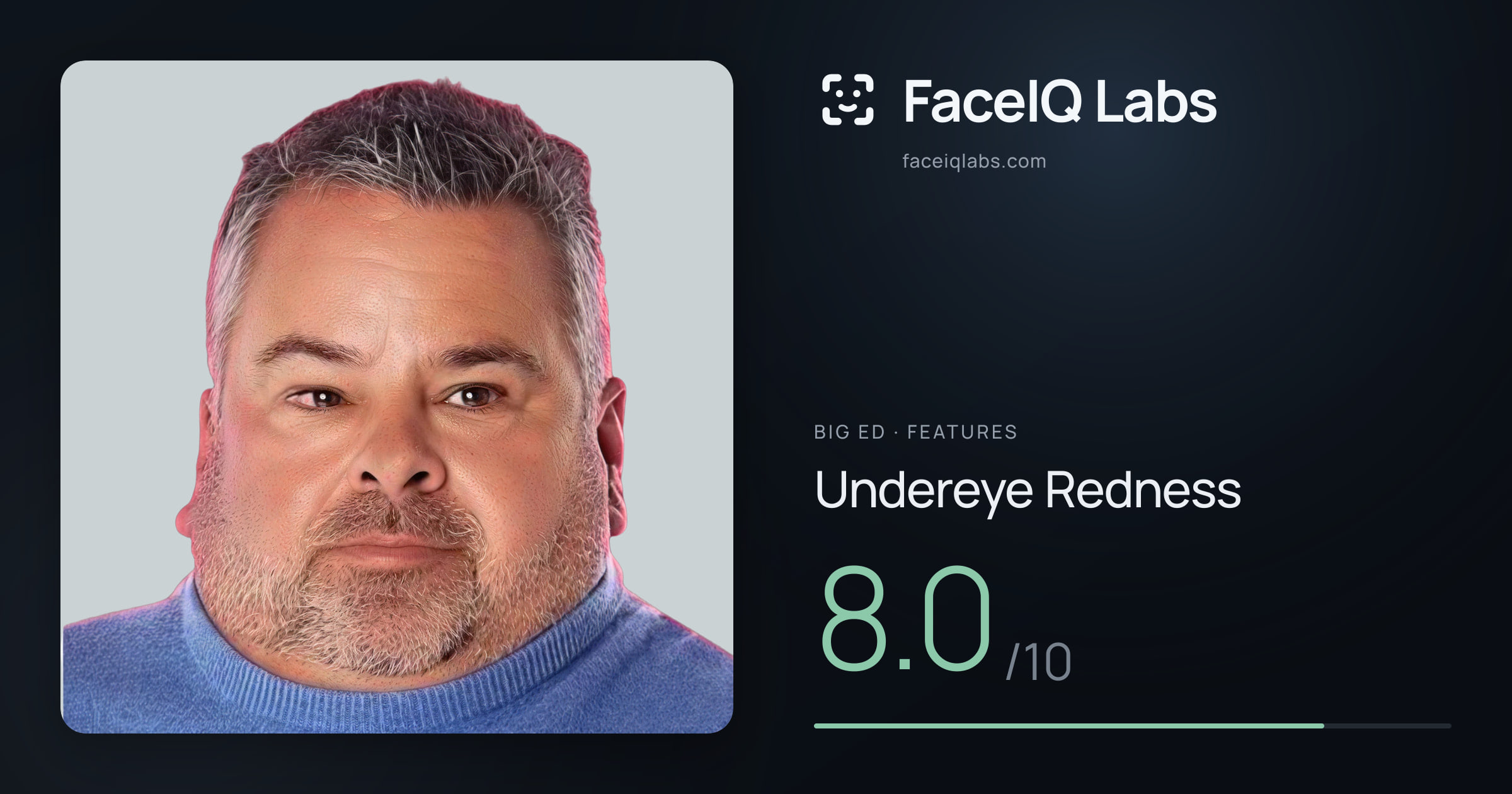 Big Ed Undereye Redness: 8.0/10, drawn on the photo