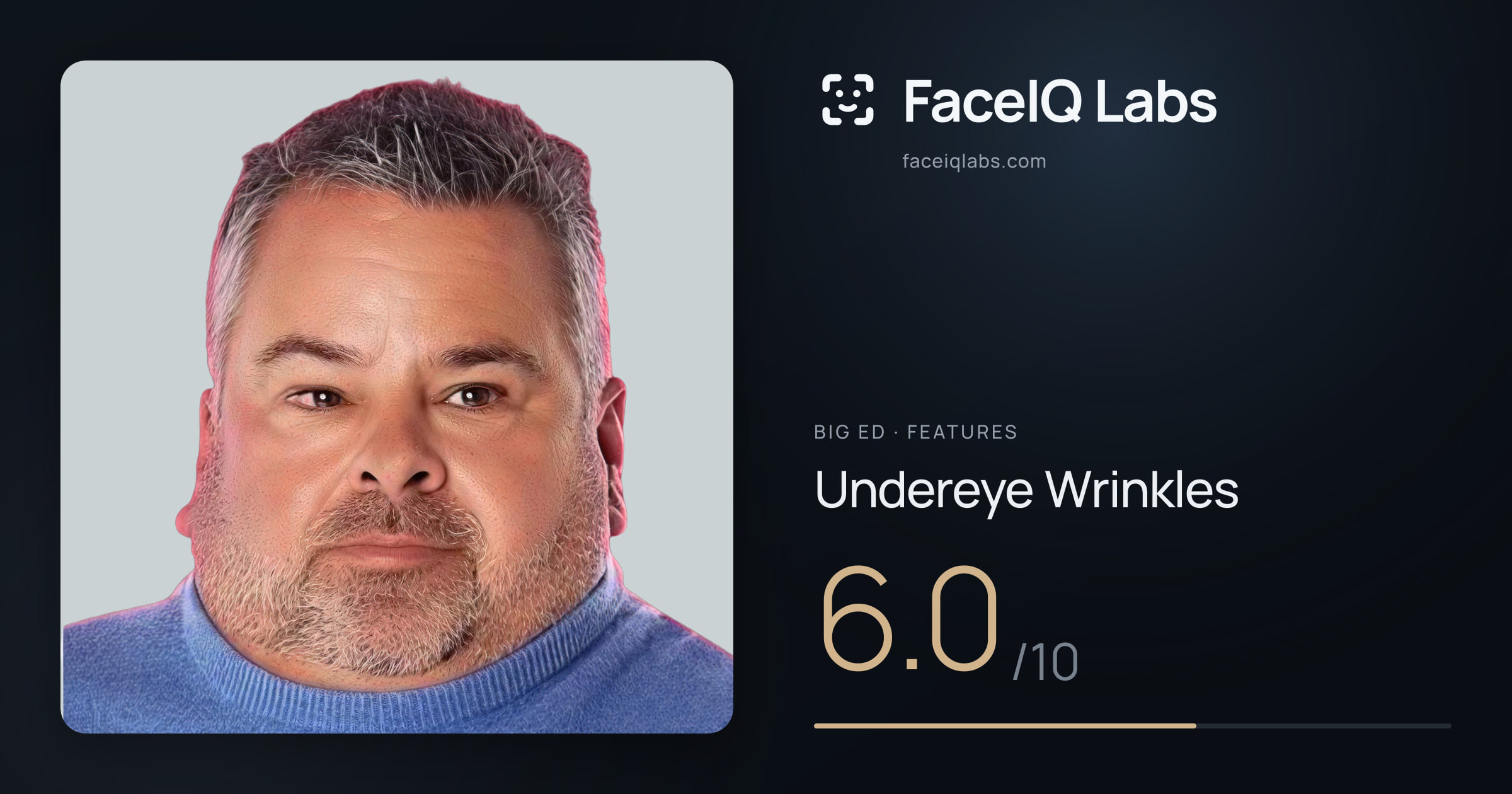 Big Ed Undereye Wrinkles: 6.0/10, drawn on the photo