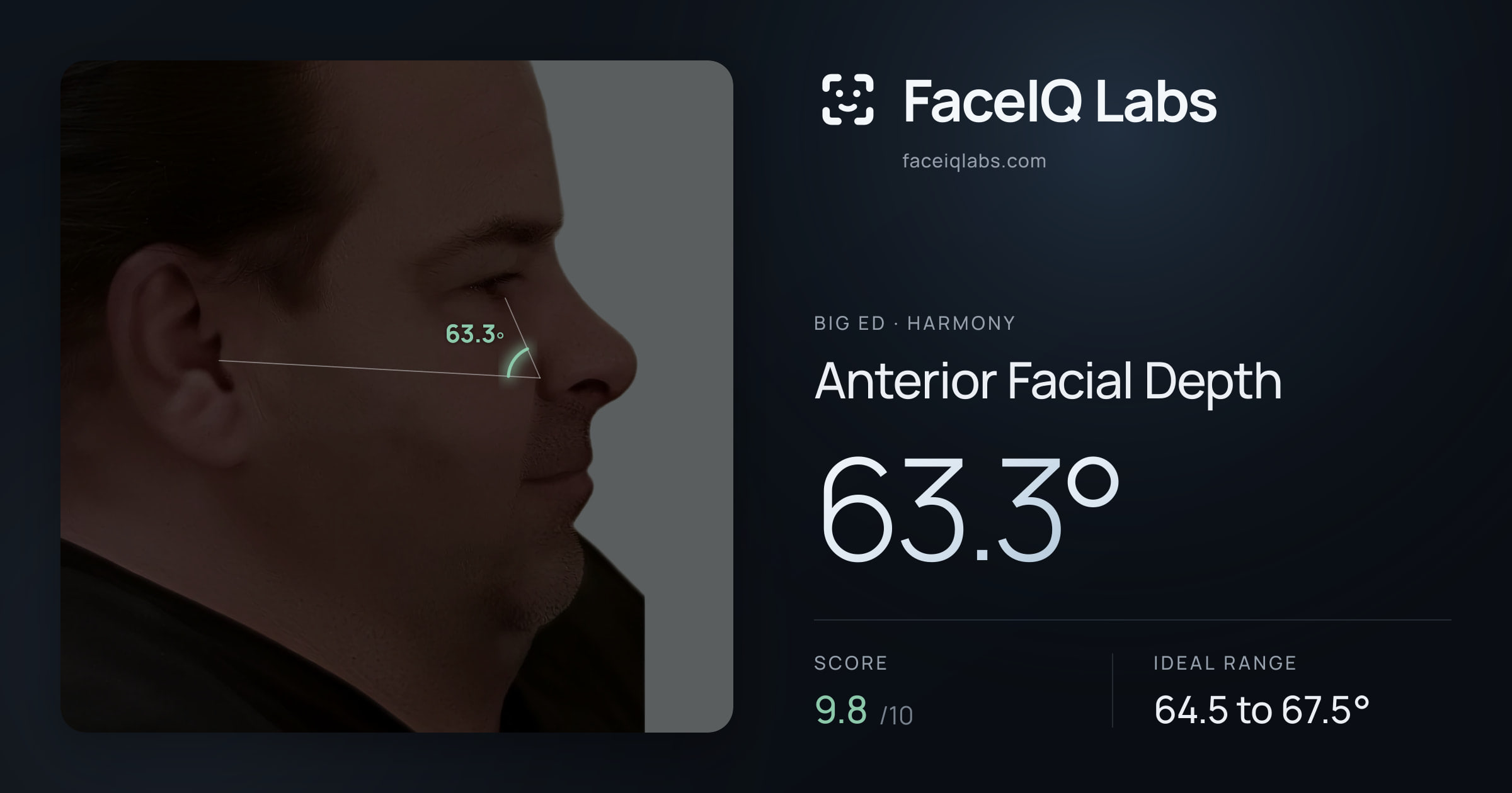 Big Ed Anterior Facial Depth: 63.3°, drawn on the photo