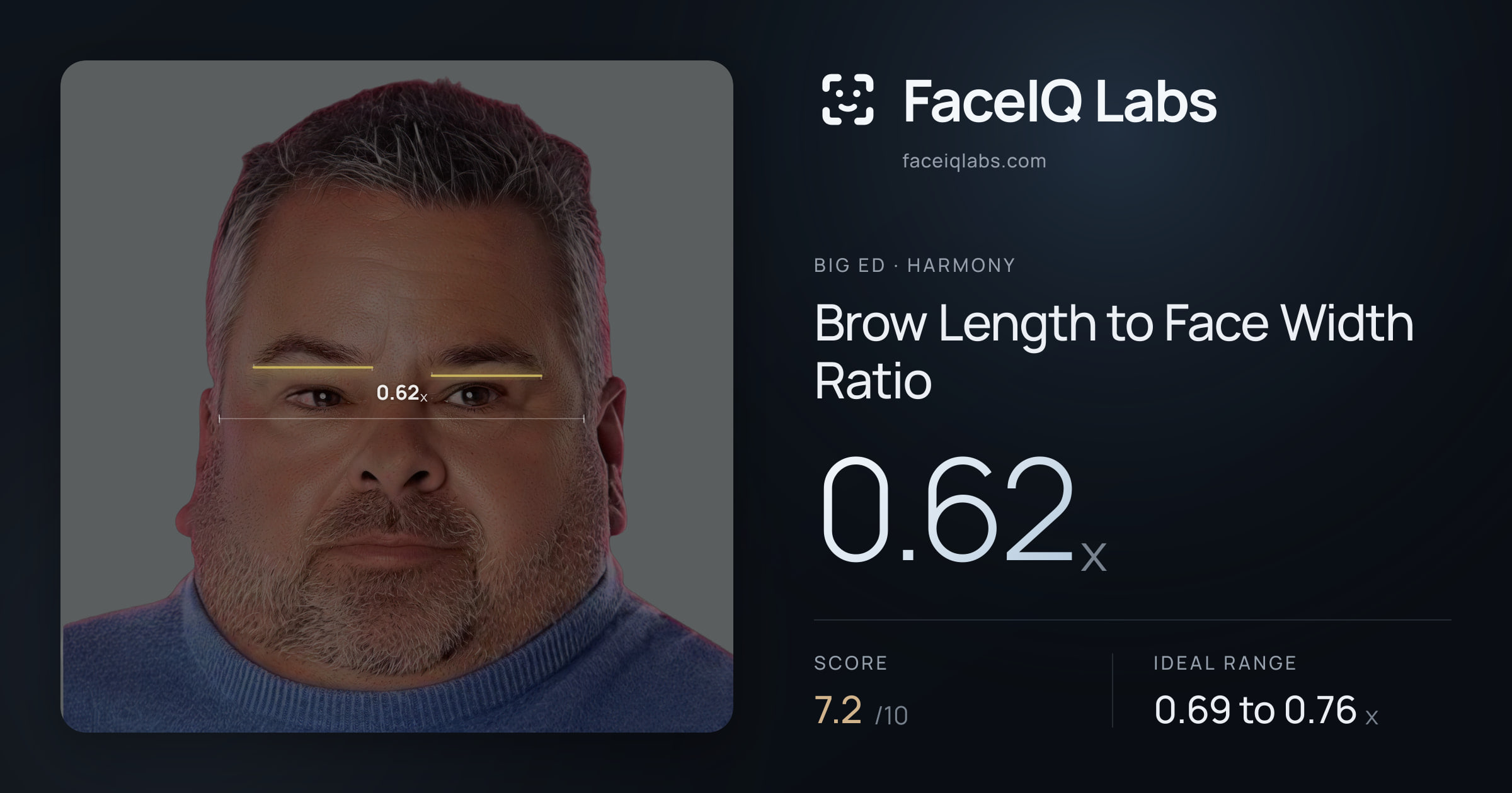 Big Ed Brow Length to Face Width Ratio: 0.62x, drawn on the photo
