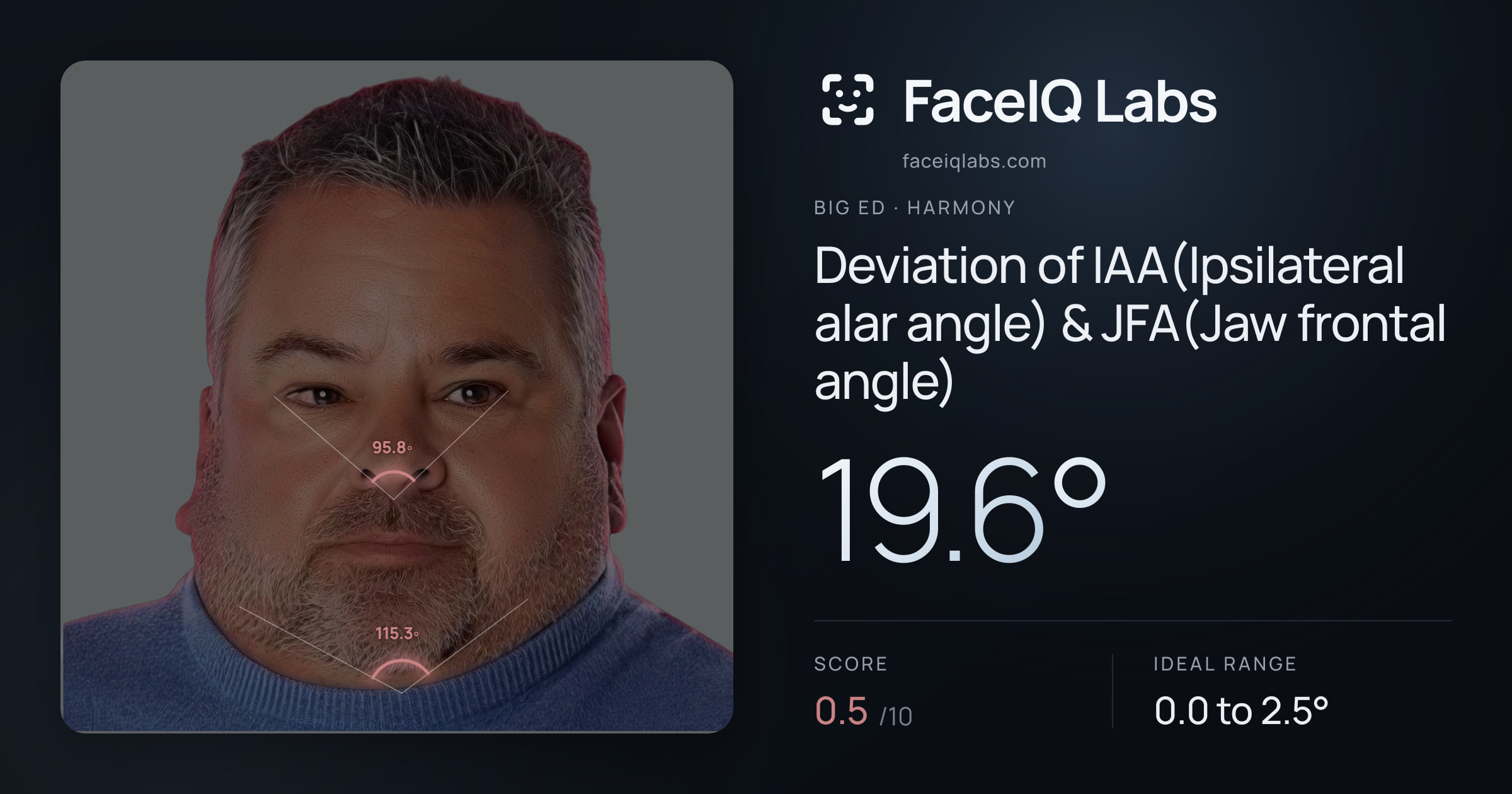 Big Ed Deviation of IAA(Ipsilateral alar angle) & JFA(Jaw frontal angle): 19.6°, drawn on the photo