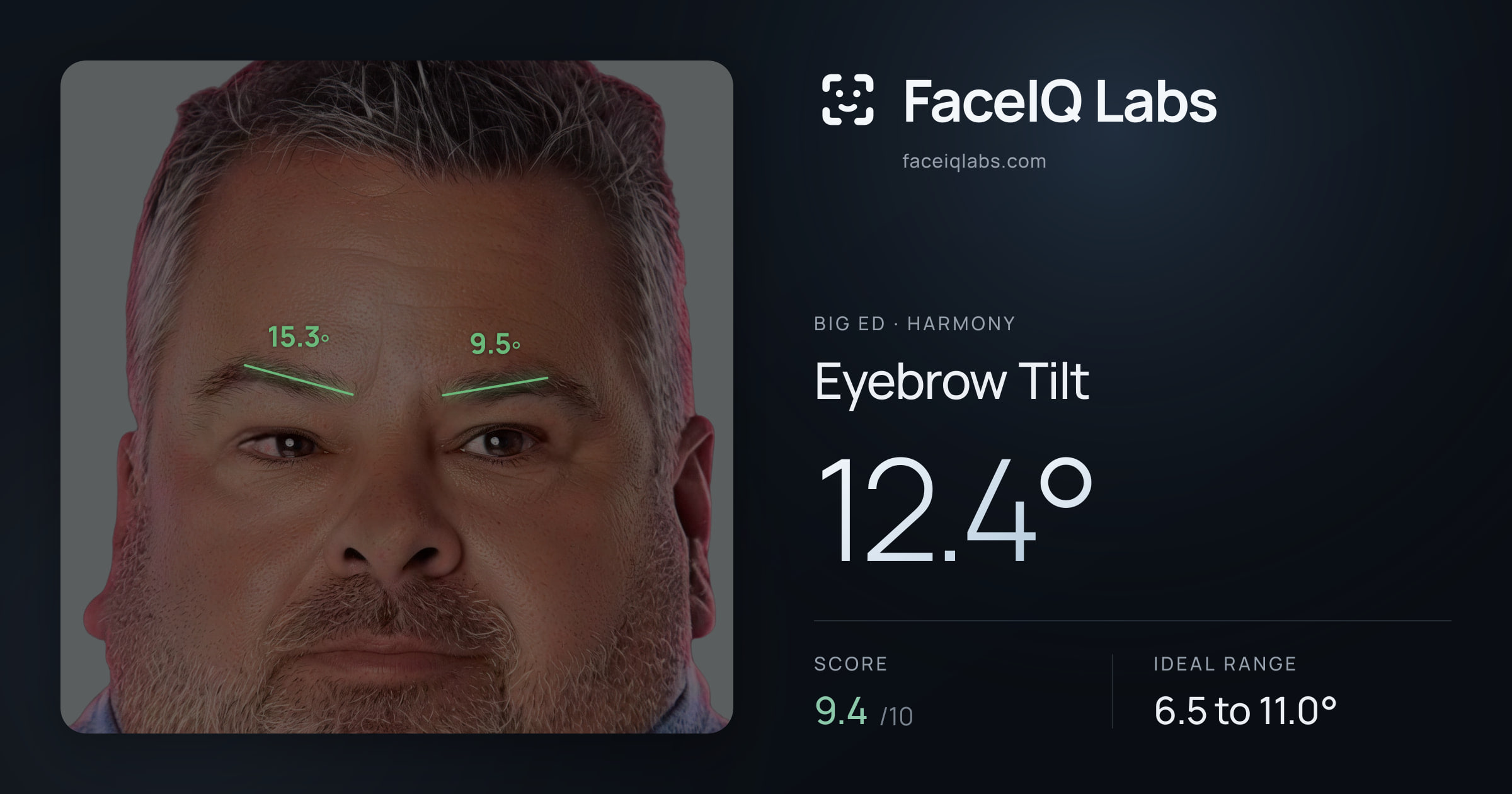 Big Ed Eyebrow Tilt: 12.4°, drawn on the photo