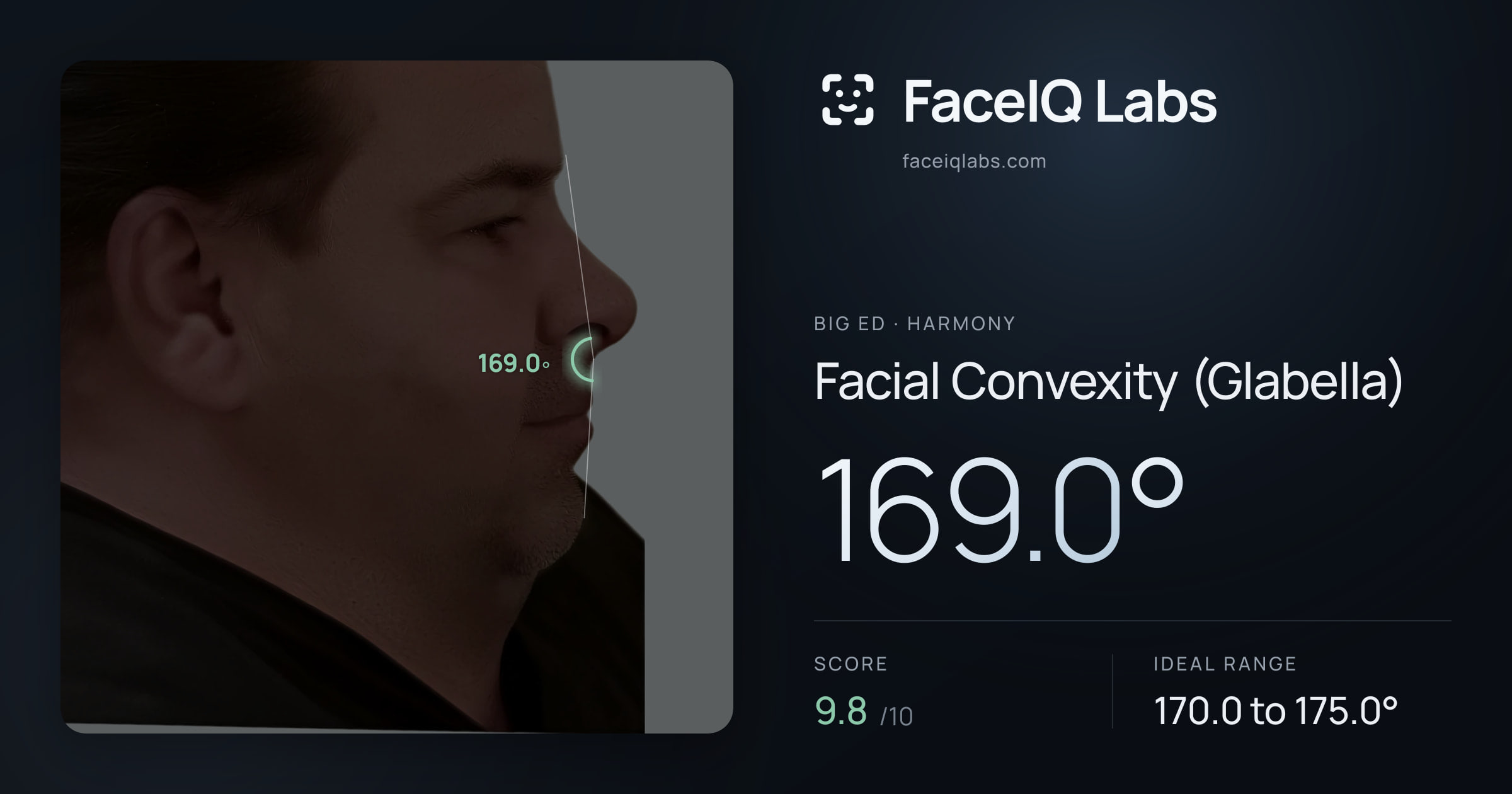 Big Ed Facial Convexity (Glabella): 169.0°, drawn on the photo