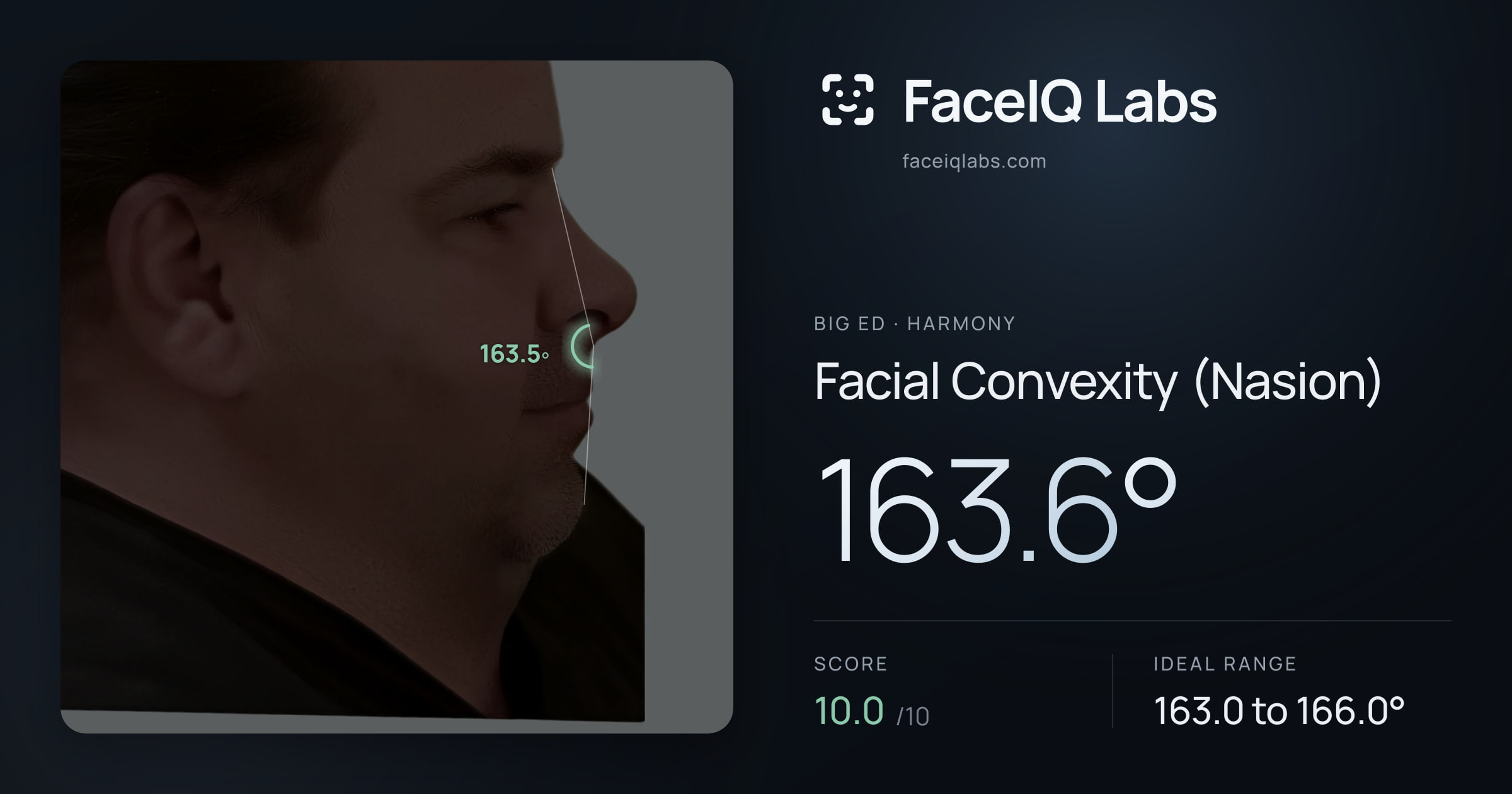Big Ed Facial Convexity (Nasion): 163.6°, drawn on the photo