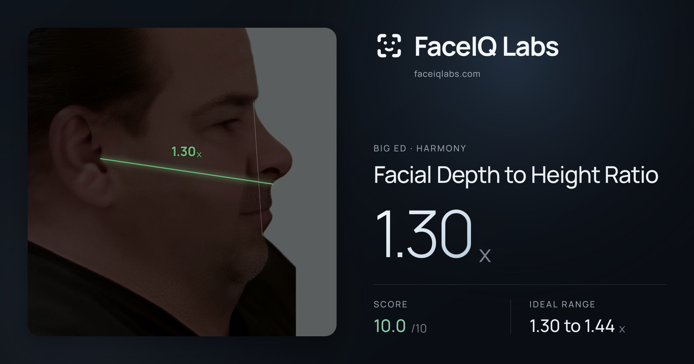 Big Ed Facial Depth to Height Ratio: 1.30x, drawn on the photo