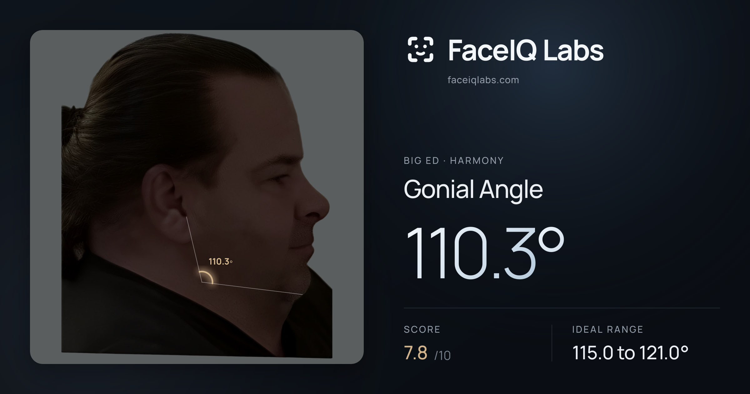 Big Ed Gonial Angle: 110.3°, drawn on the photo