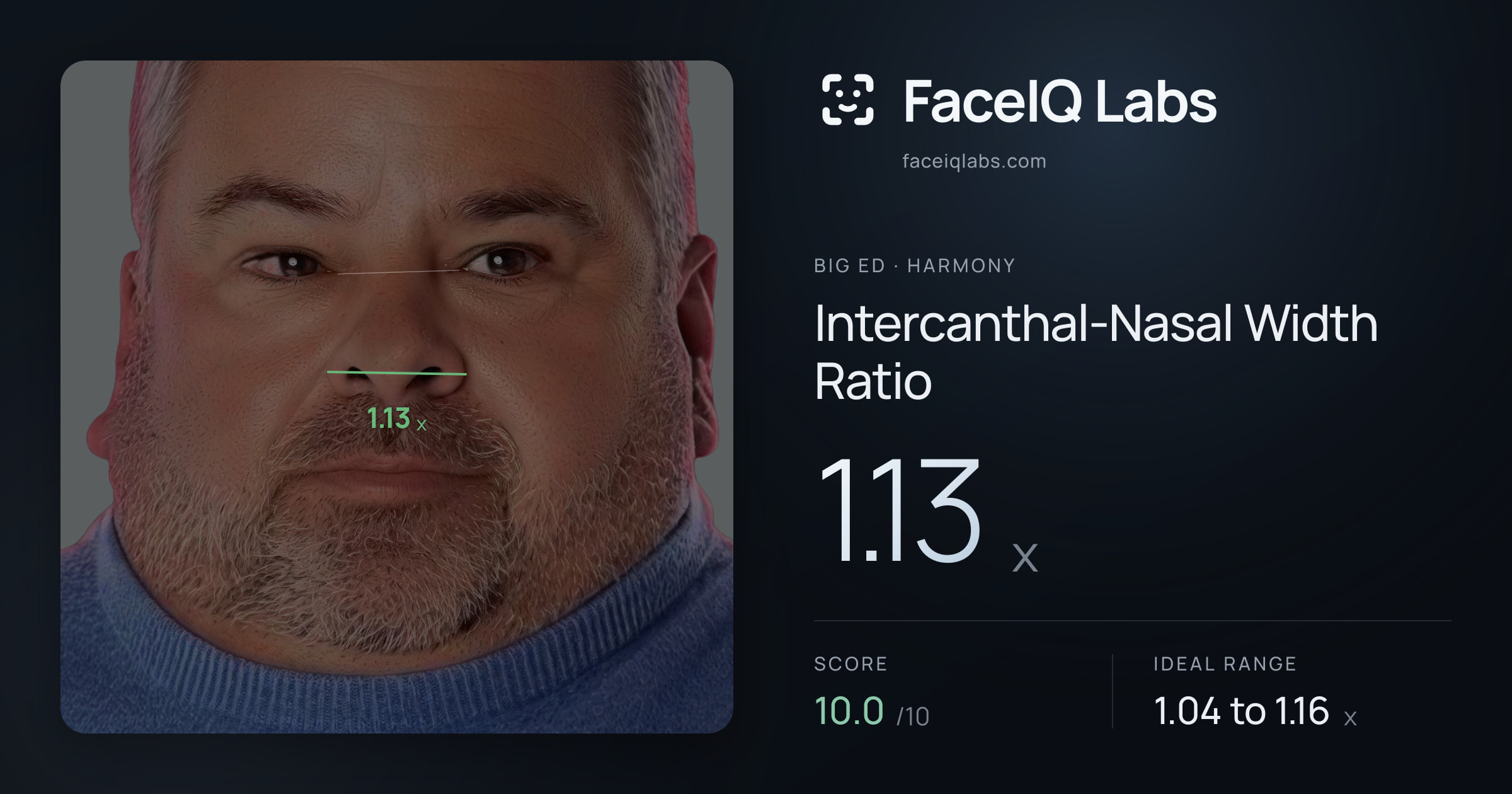 Big Ed Intercanthal-Nasal Width Ratio: 1.13x, drawn on the photo