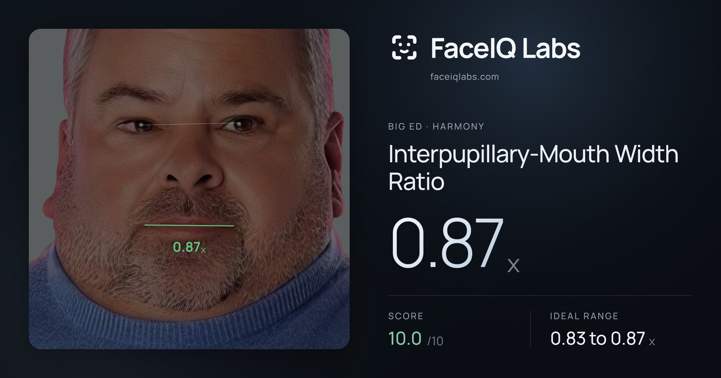 Big Ed Interpupillary-Mouth Width Ratio: 0.87x, drawn on the photo