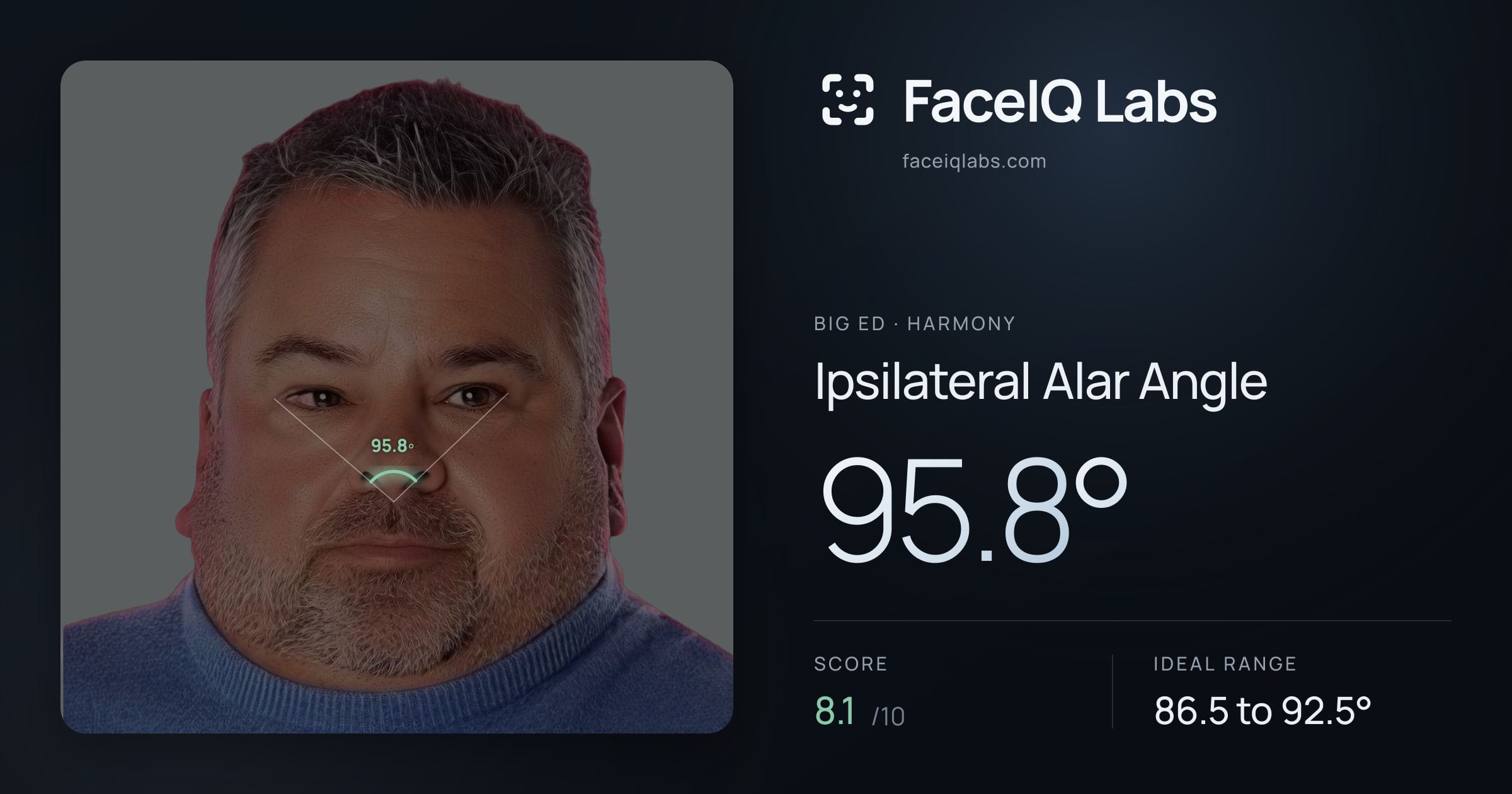 Big Ed Ipsilateral Alar Angle: 95.8°, drawn on the photo