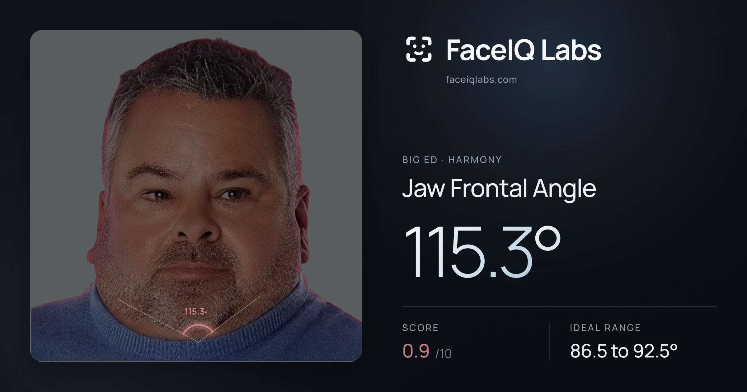 Big Ed Jaw Frontal Angle: 115.3°, drawn on the photo