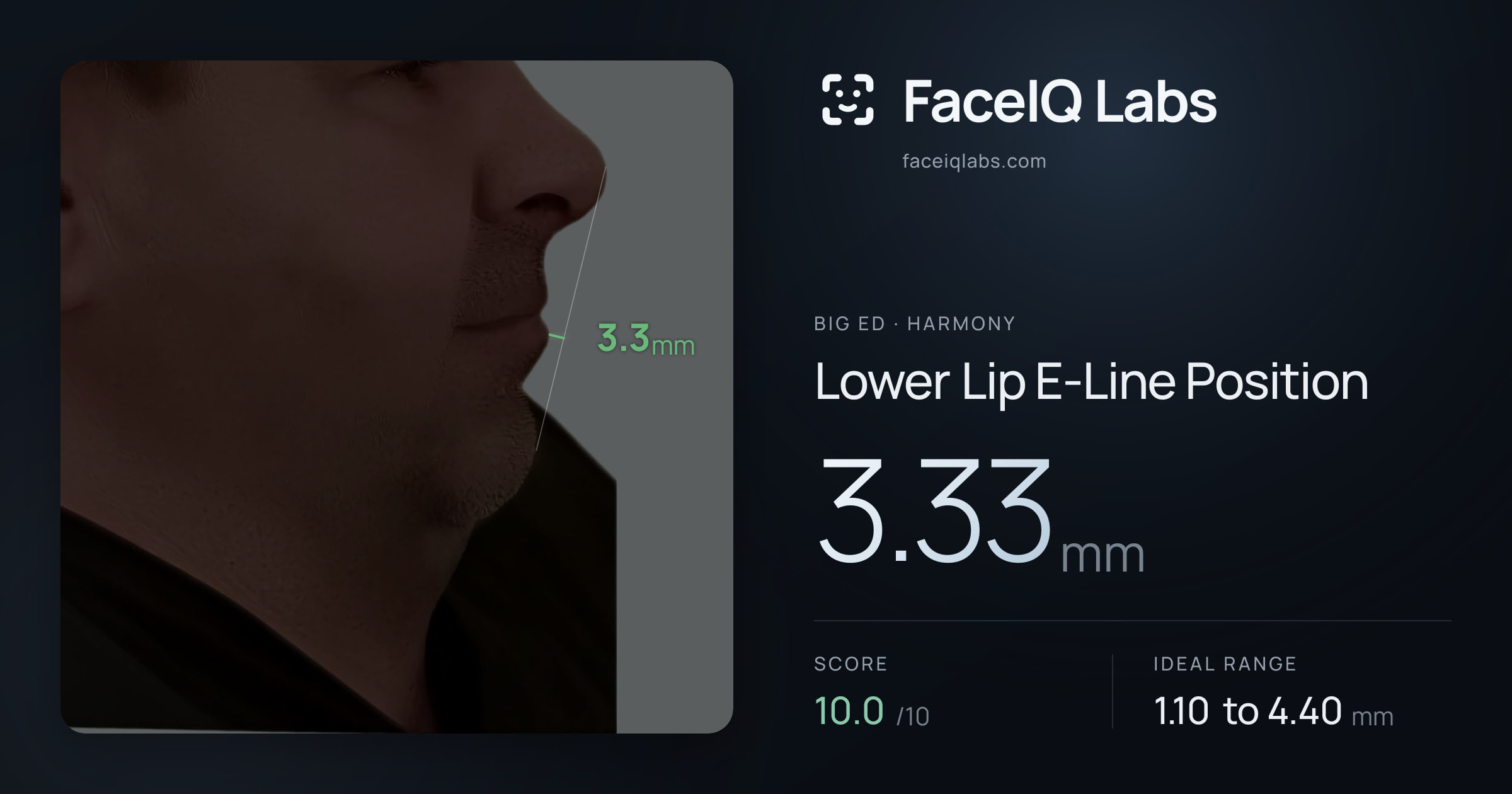 Big Ed Lower Lip E-Line Position: 3.33mm, drawn on the photo