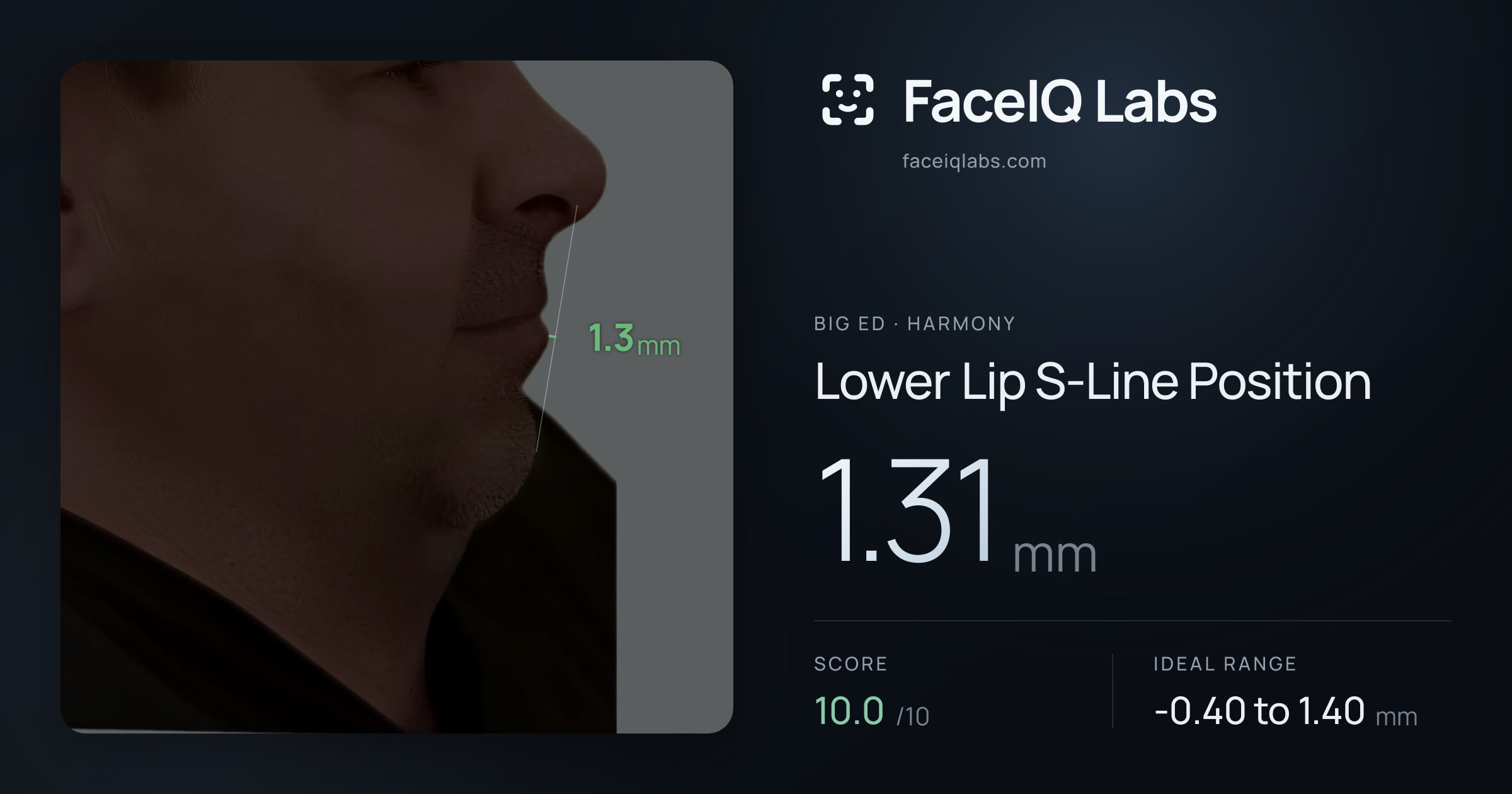 Big Ed Lower Lip S-Line Position: 1.31mm, drawn on the photo