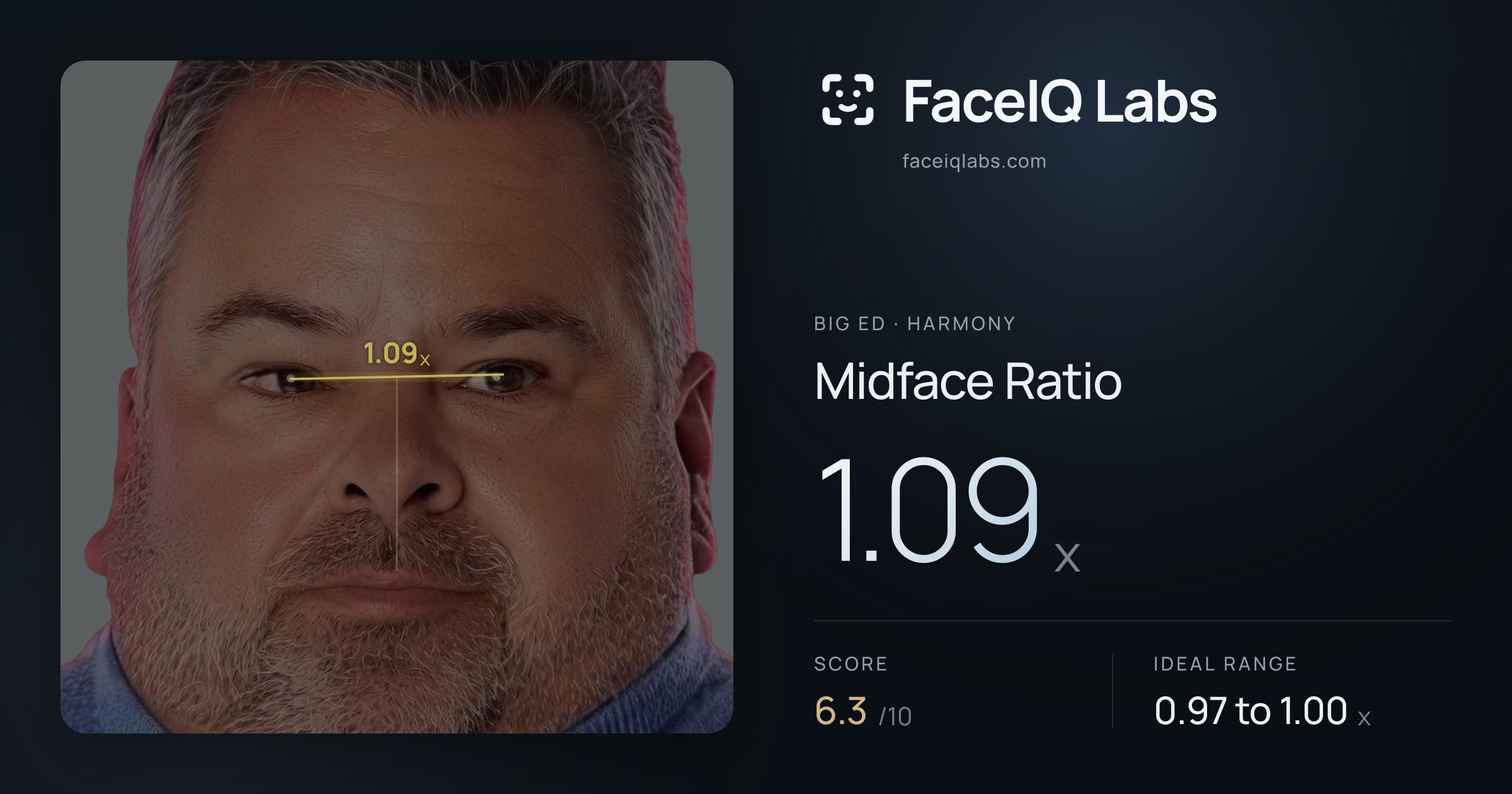 Big Ed Midface Ratio: 1.09x, drawn on the photo