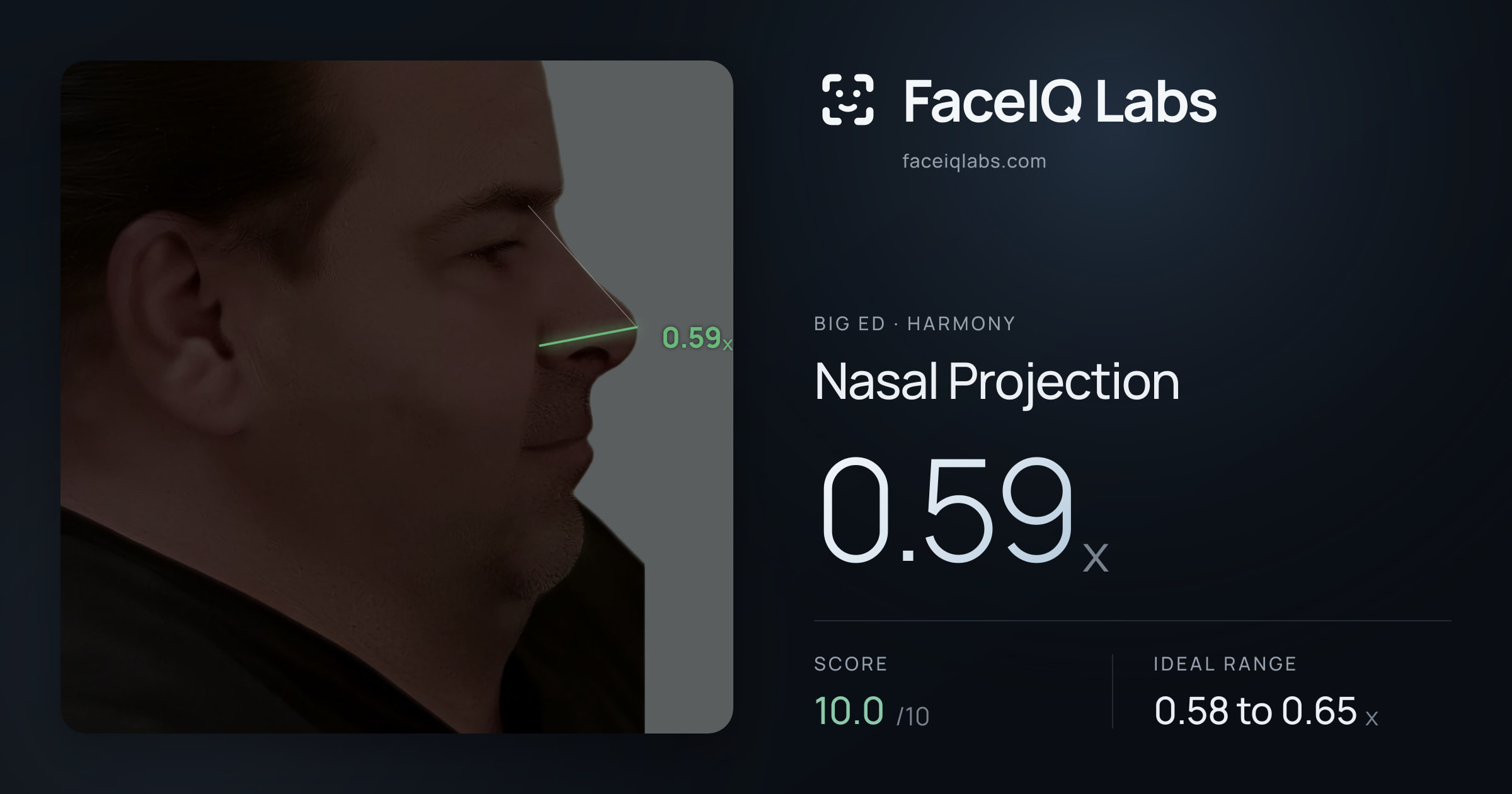 Big Ed Nasal Projection: 0.59x, drawn on the photo