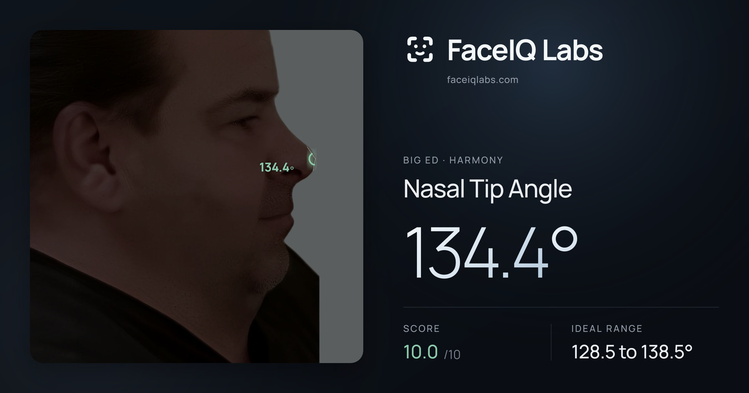 Big Ed Nasal Tip Angle: 134.4°, drawn on the photo