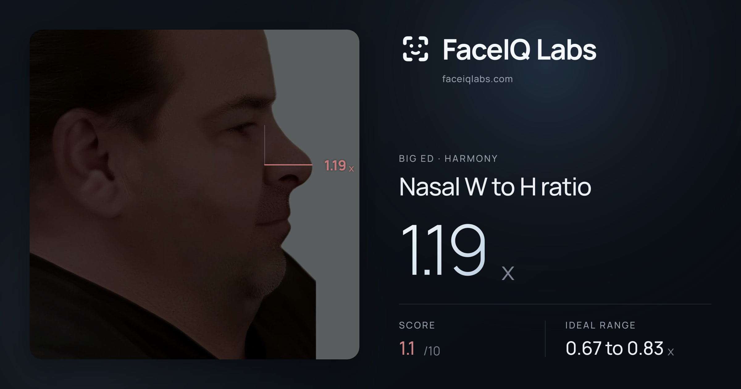 Big Ed Nasal W to H ratio: 1.19x, drawn on the photo
