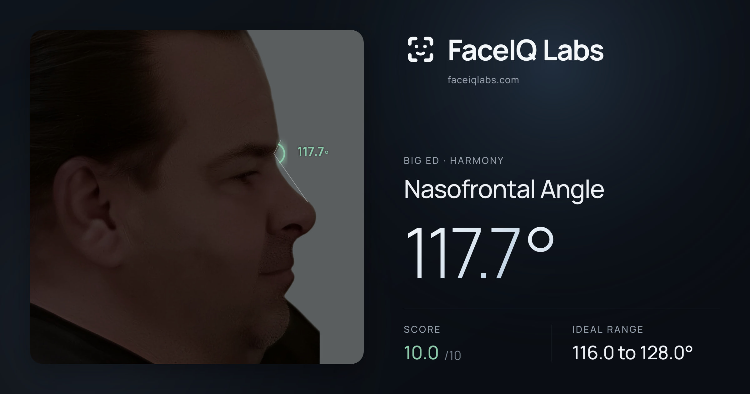 Big Ed Nasofrontal Angle: 117.7°, drawn on the photo