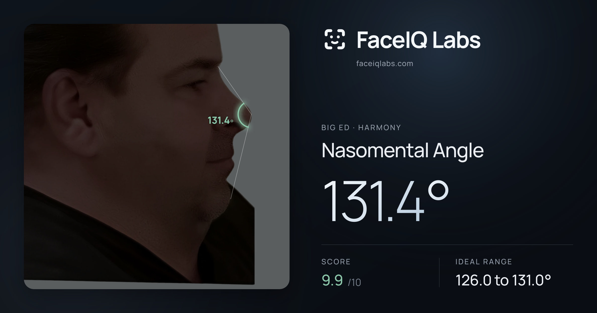 Big Ed Nasomental Angle: 131.4°, drawn on the photo