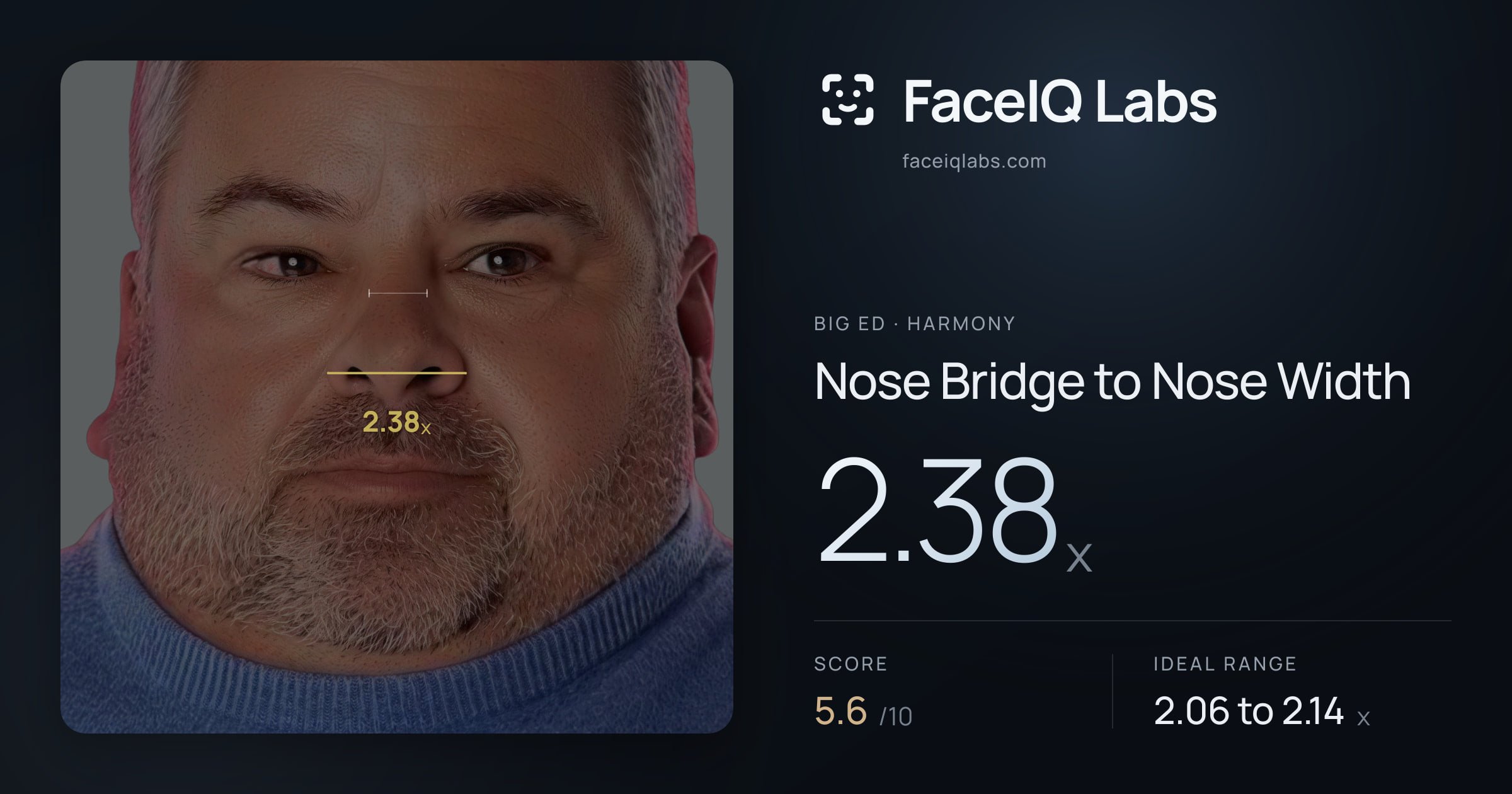 Big Ed Nose Bridge to Nose Width: 2.38x, drawn on the photo