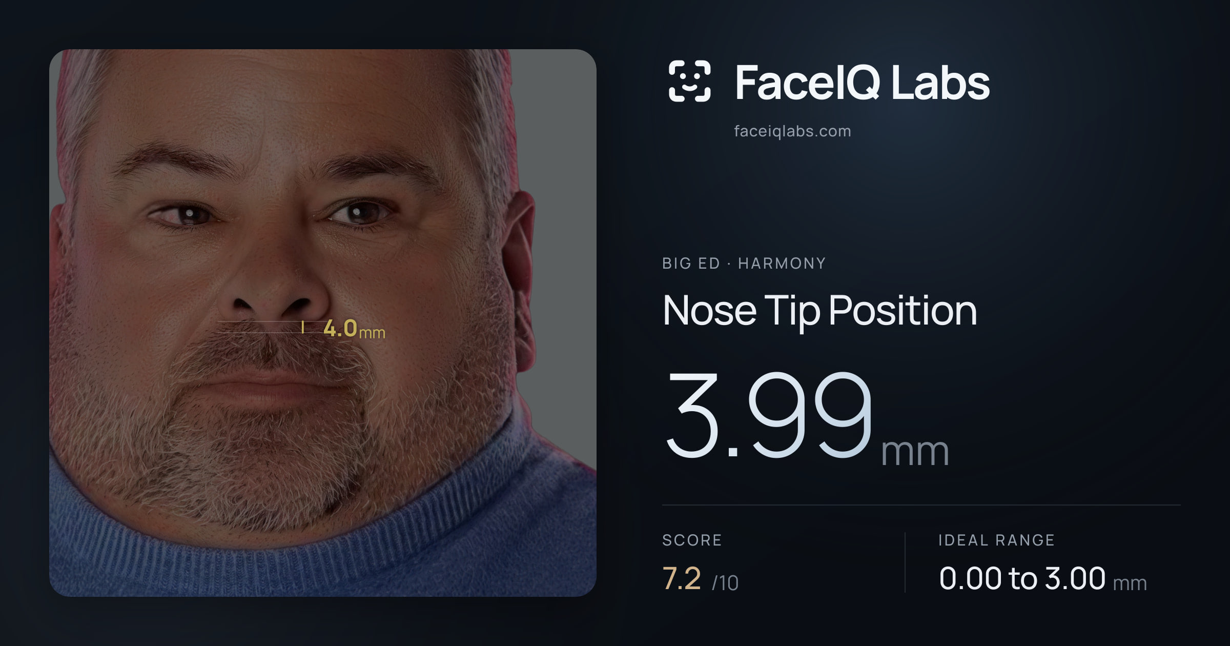Big Ed Nose Tip Position: 3.99mm, drawn on the photo