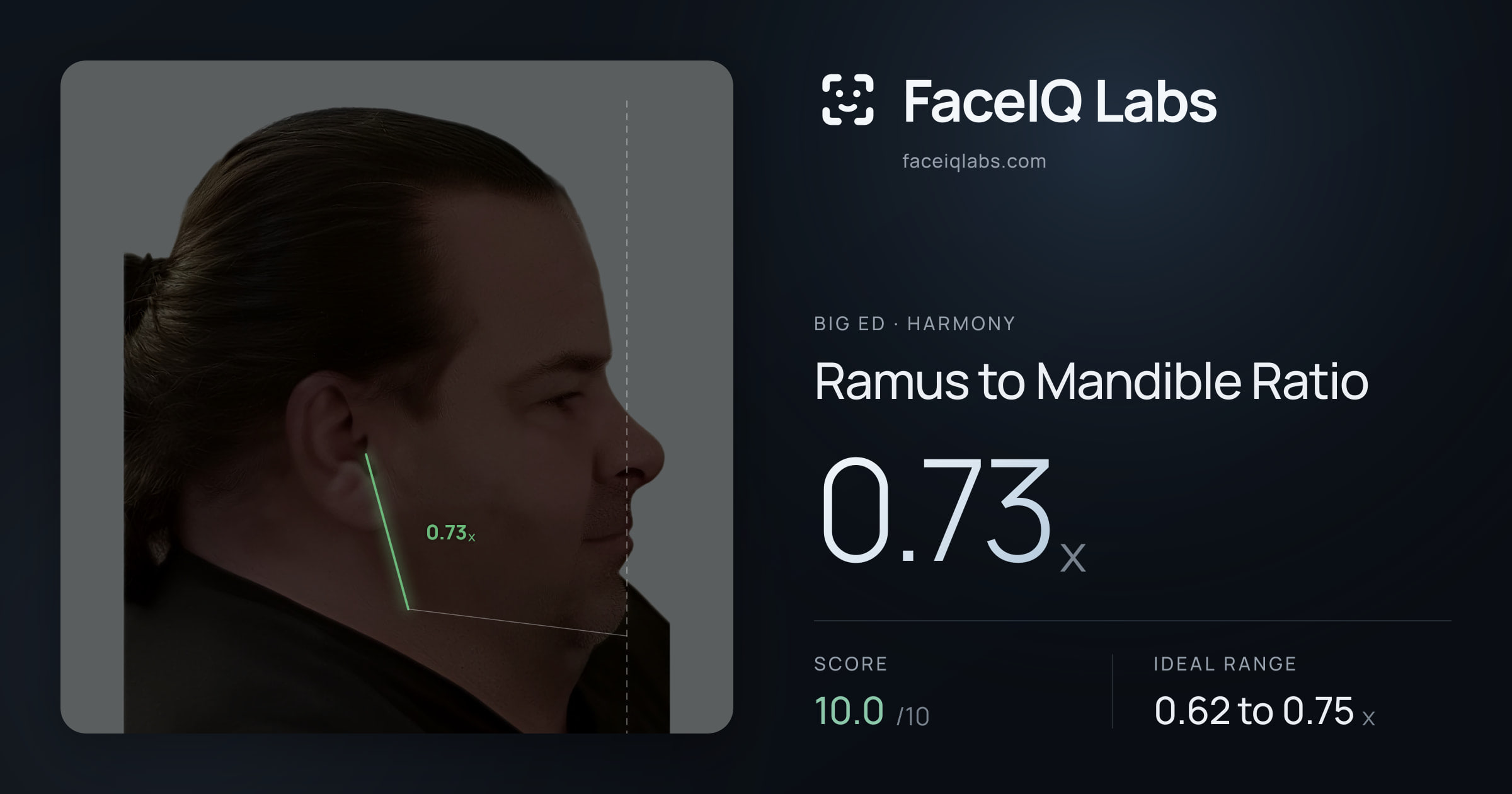 Big Ed Ramus to Mandible Ratio: 0.73x, drawn on the photo