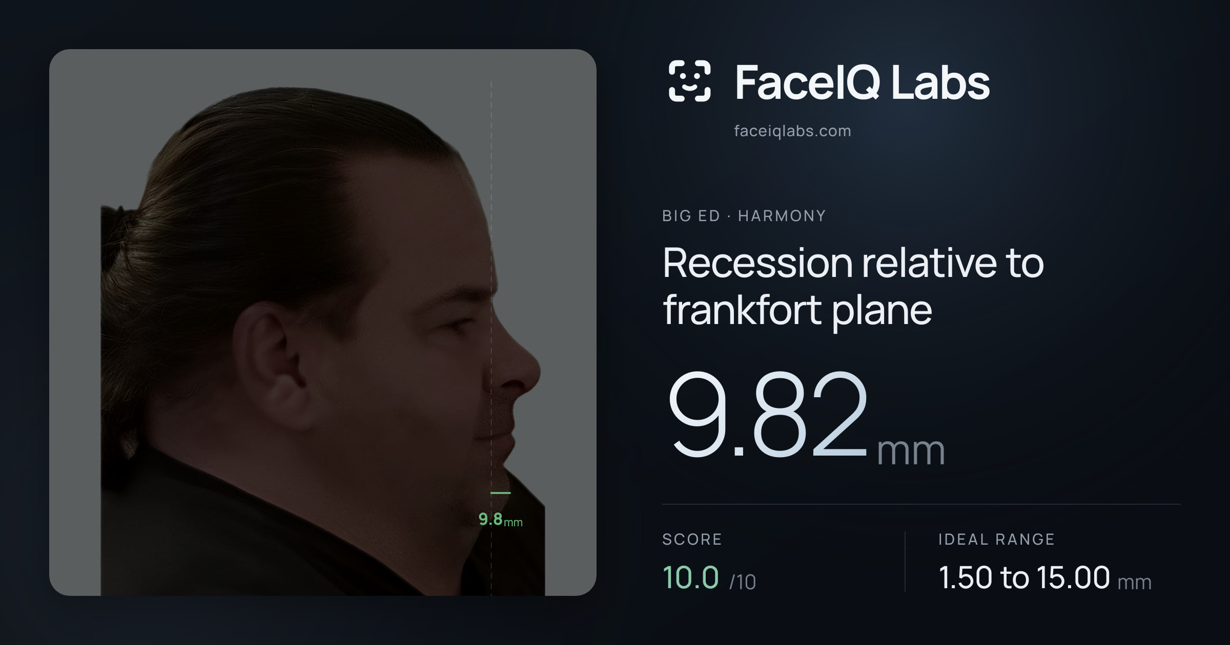 Big Ed Recession relative to frankfort plane: 9.82mm, drawn on the photo