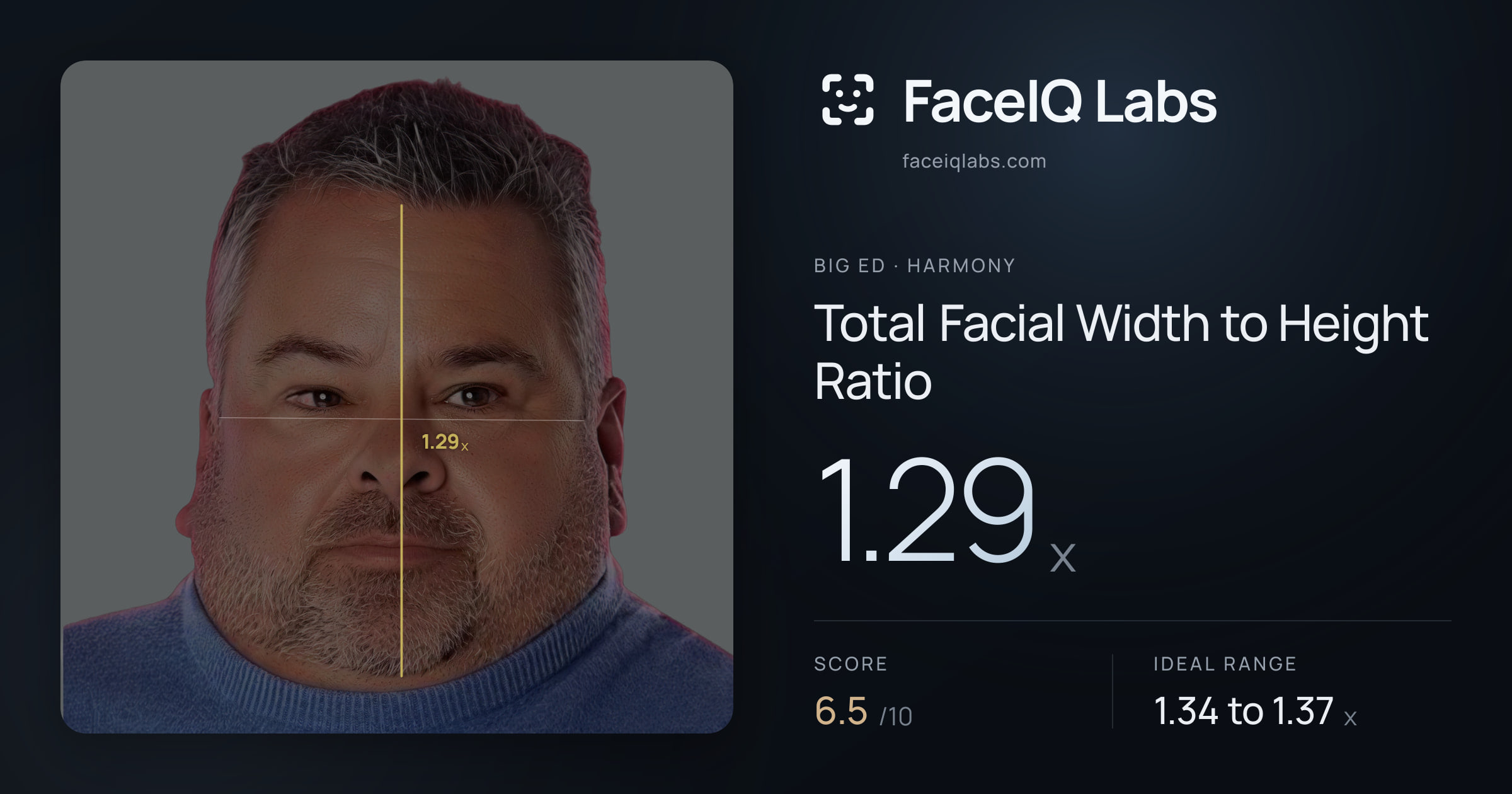 Big Ed Total Facial Width to Height Ratio: 1.29x, drawn on the photo