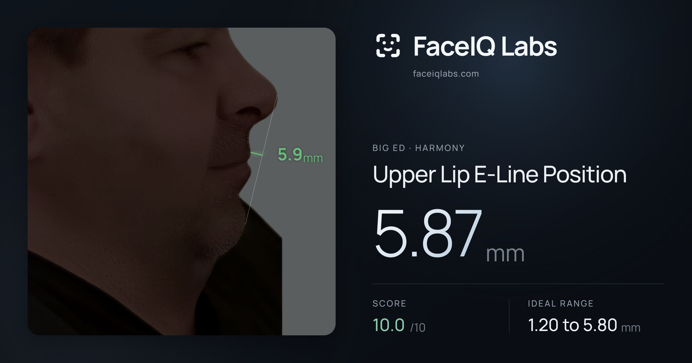 Big Ed Upper Lip E-Line Position: 5.87mm, drawn on the photo