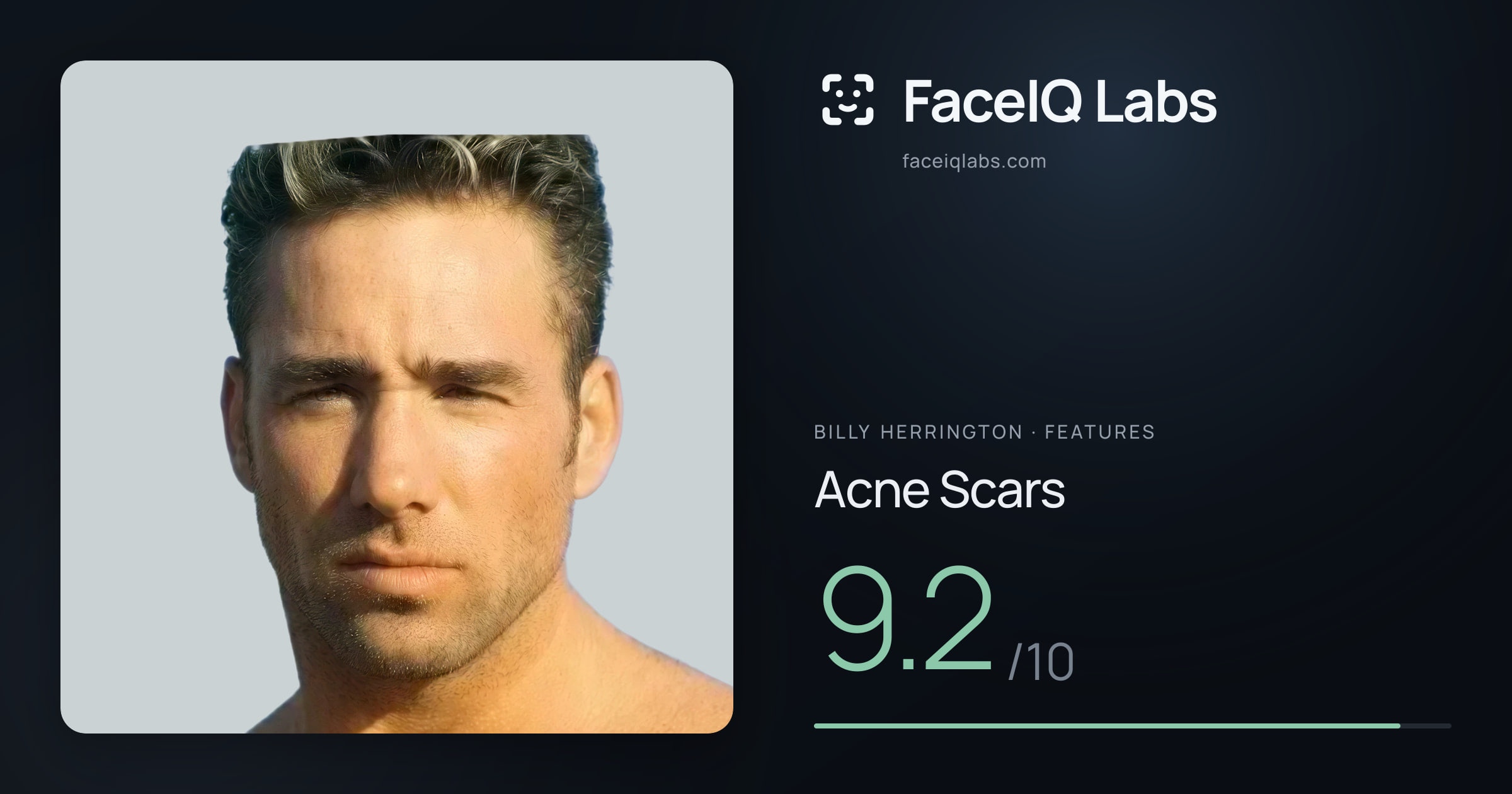 Billy Herrington Acne Scars: 9.2/10, drawn on the photo