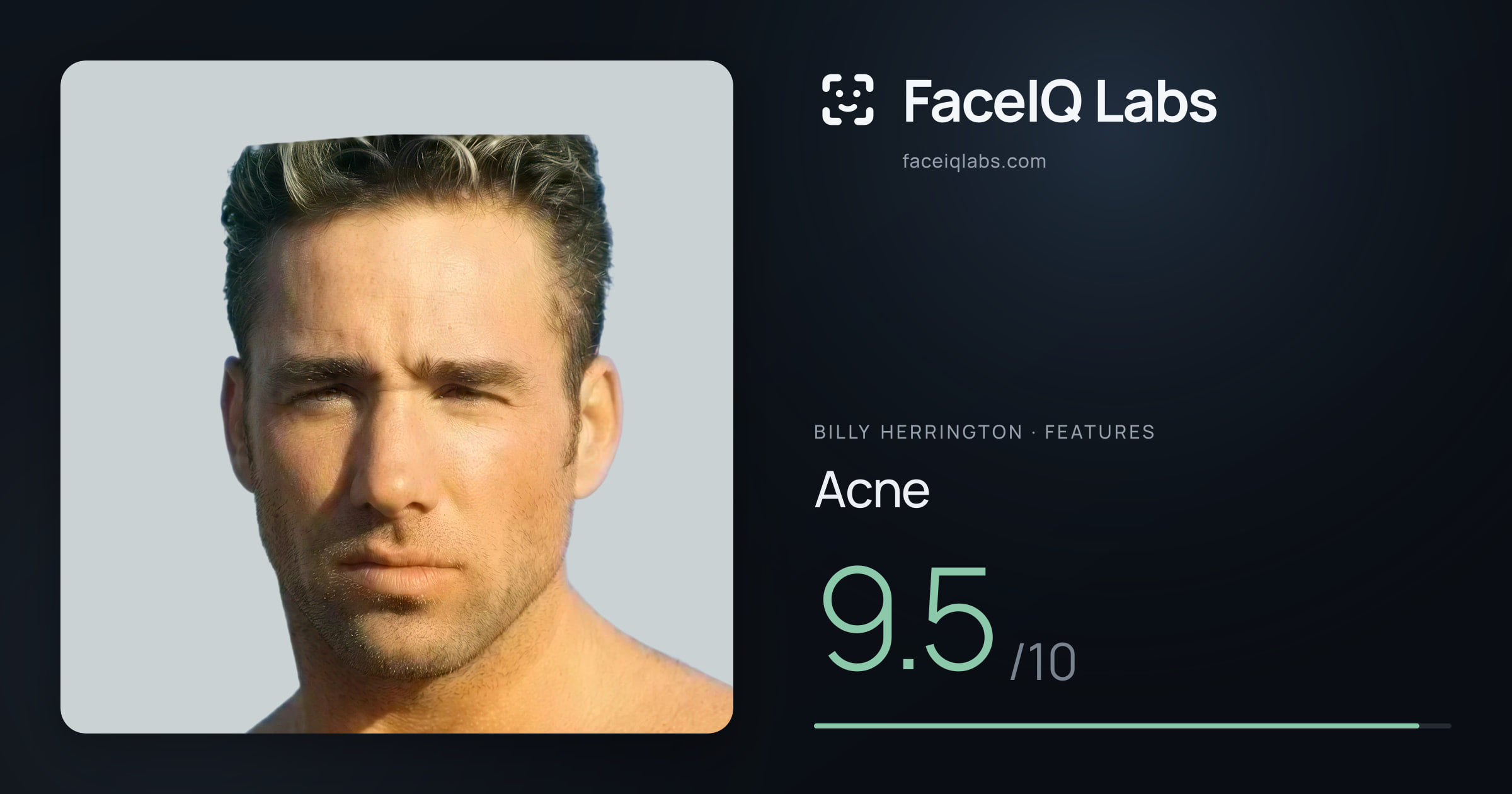 Billy Herrington Acne: 9.5/10, drawn on the photo
