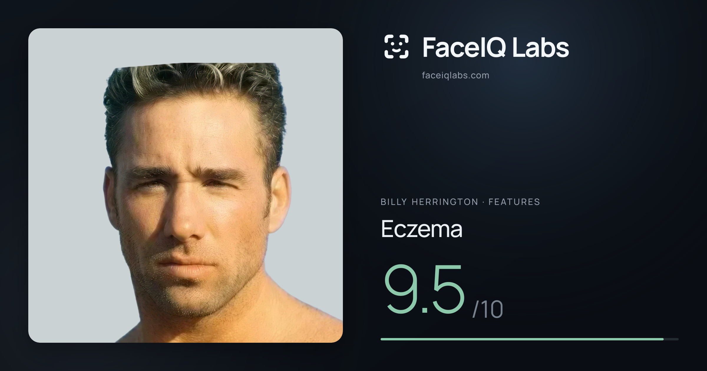 Billy Herrington Eczema: 9.5/10, drawn on the photo